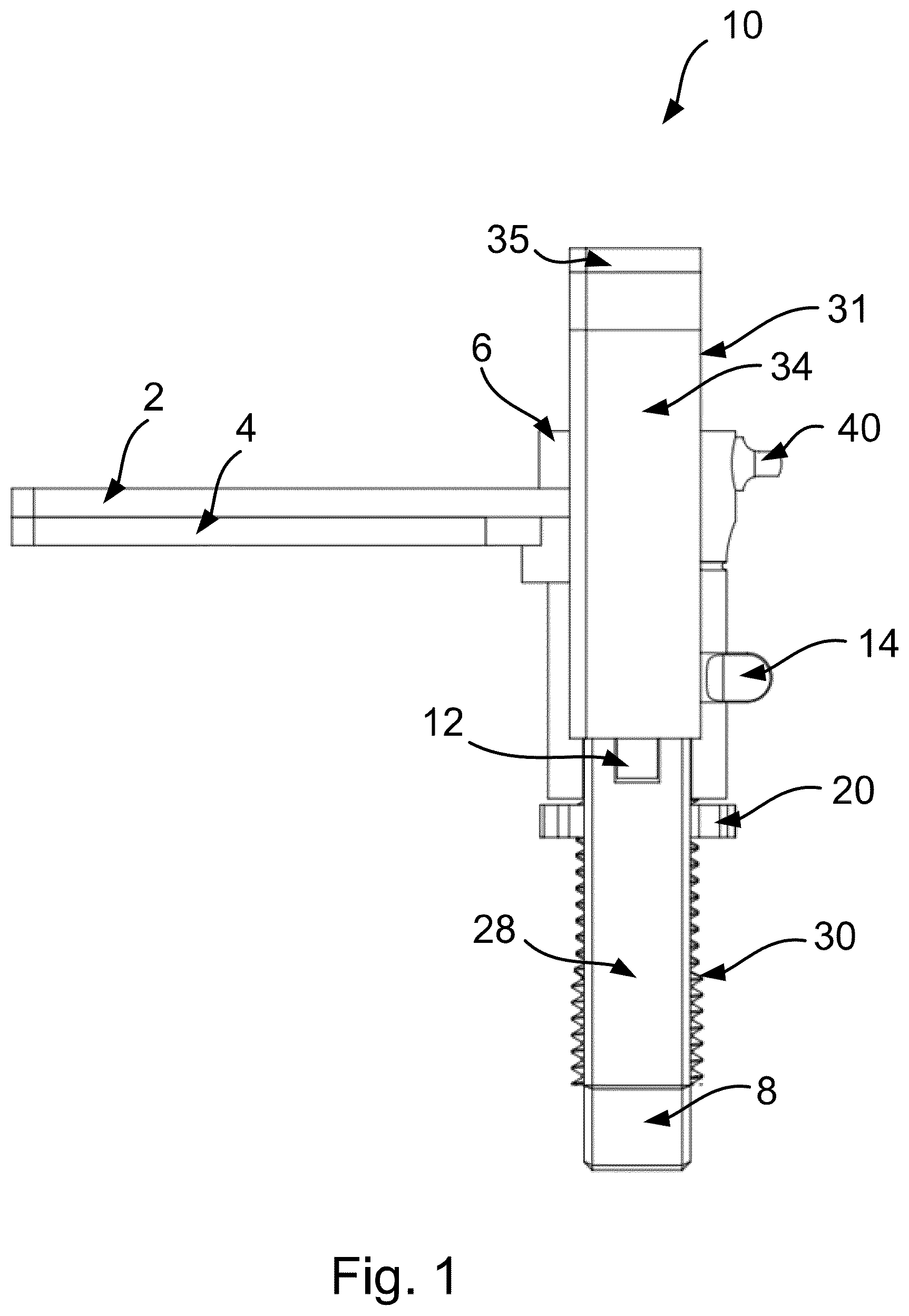 Patent US12599528 — Unicondylar balancer and method — Figure 1