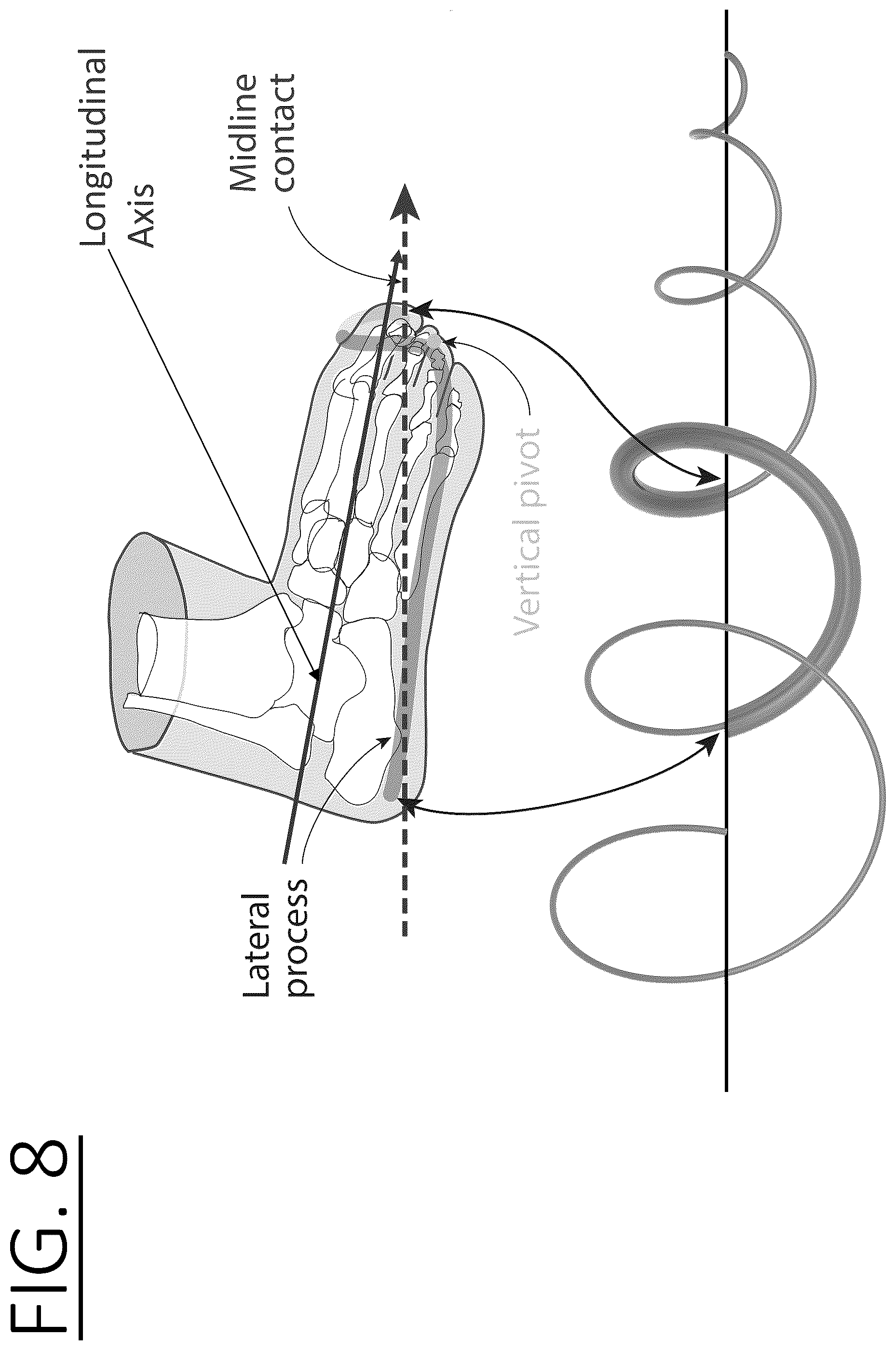Patent US12599532 Figure 8 – Three dimensional log spiral structures for improving transportation