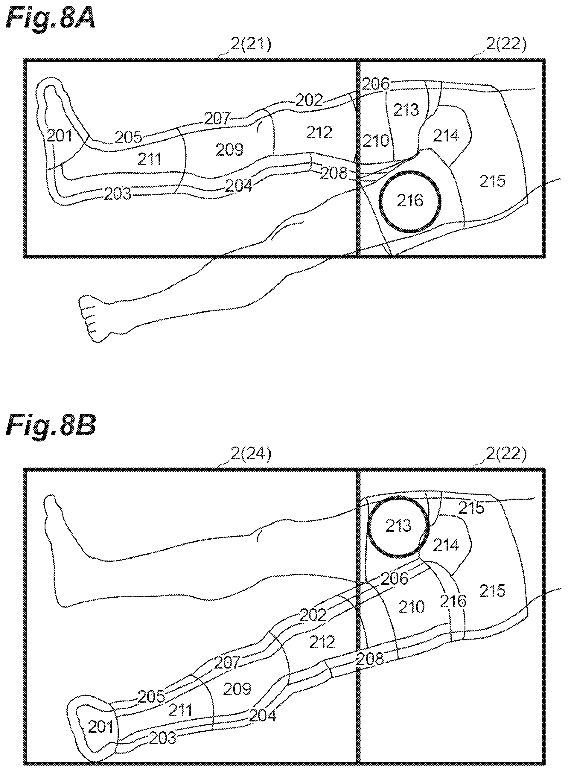 Patent US12599534 Figure 8 – Air pump device with wireless communication