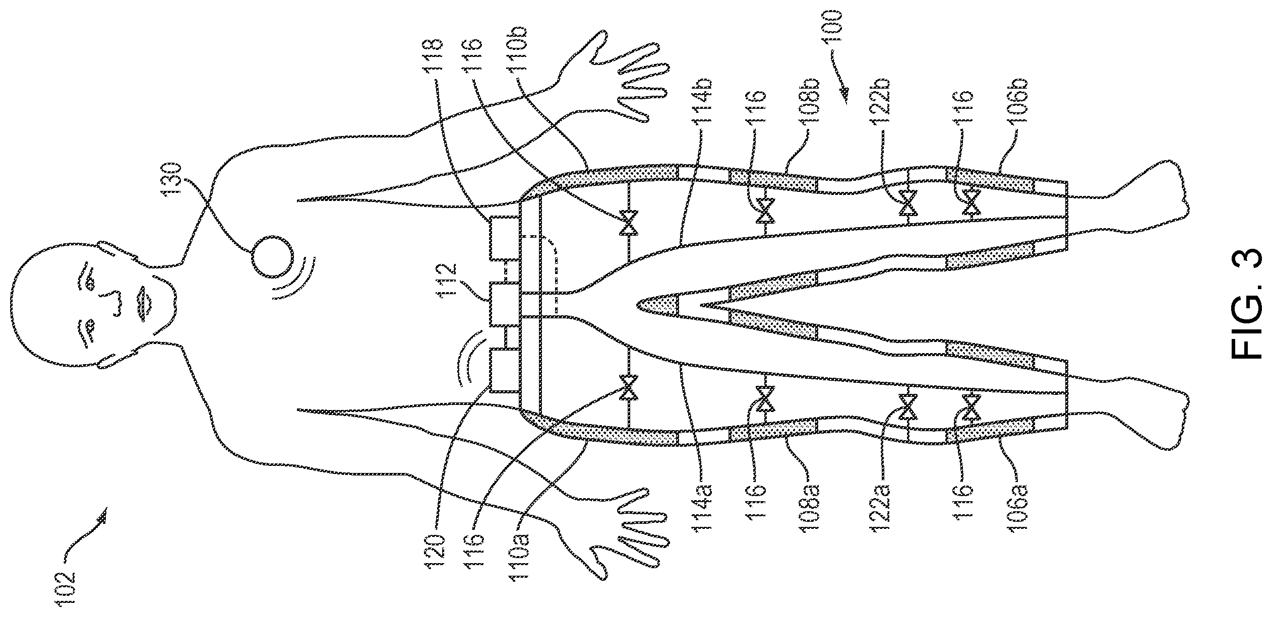 Patent US12599535 Figure 2 – External counterpulsation system