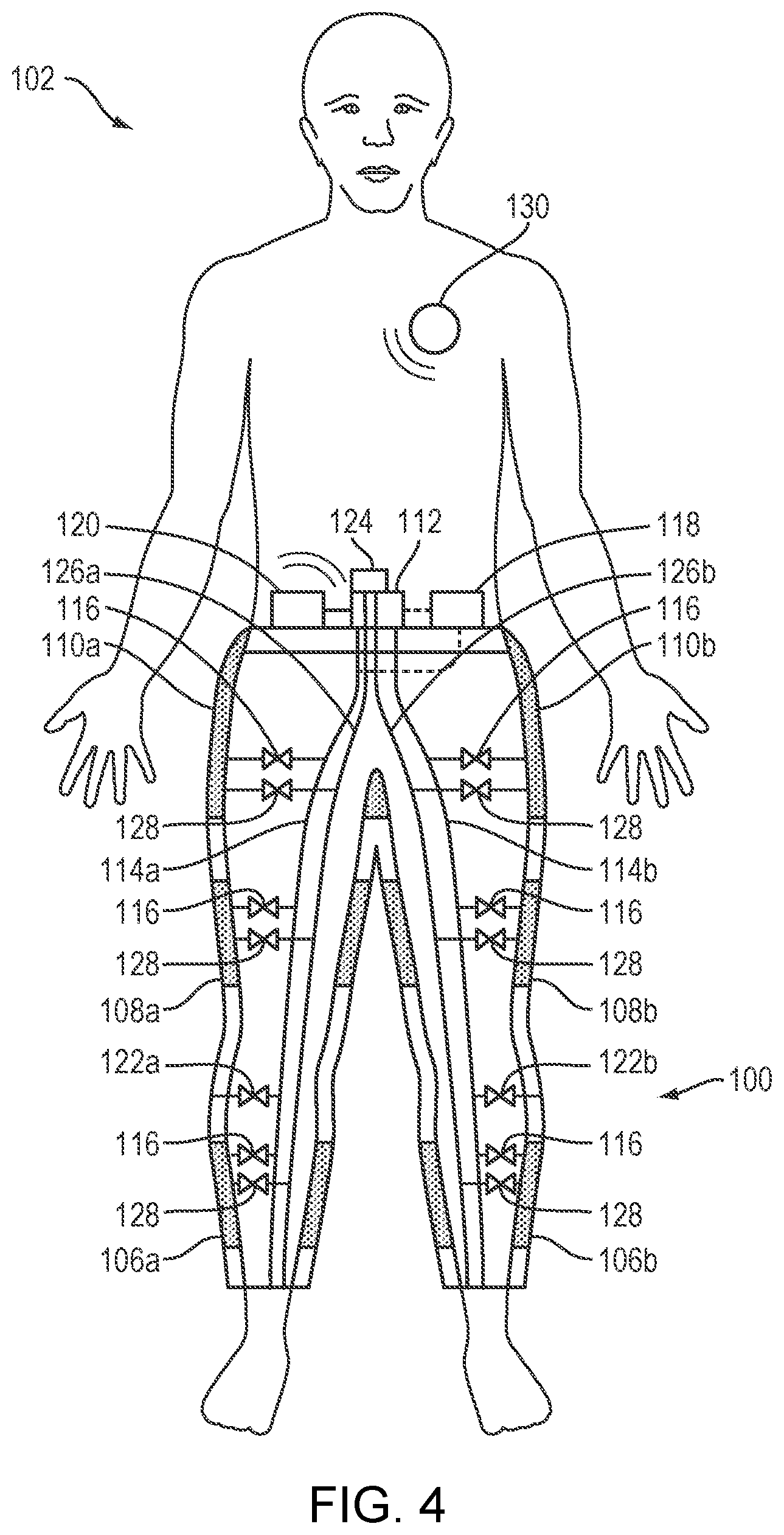 Patent US12599535 Figure 3 – External counterpulsation system