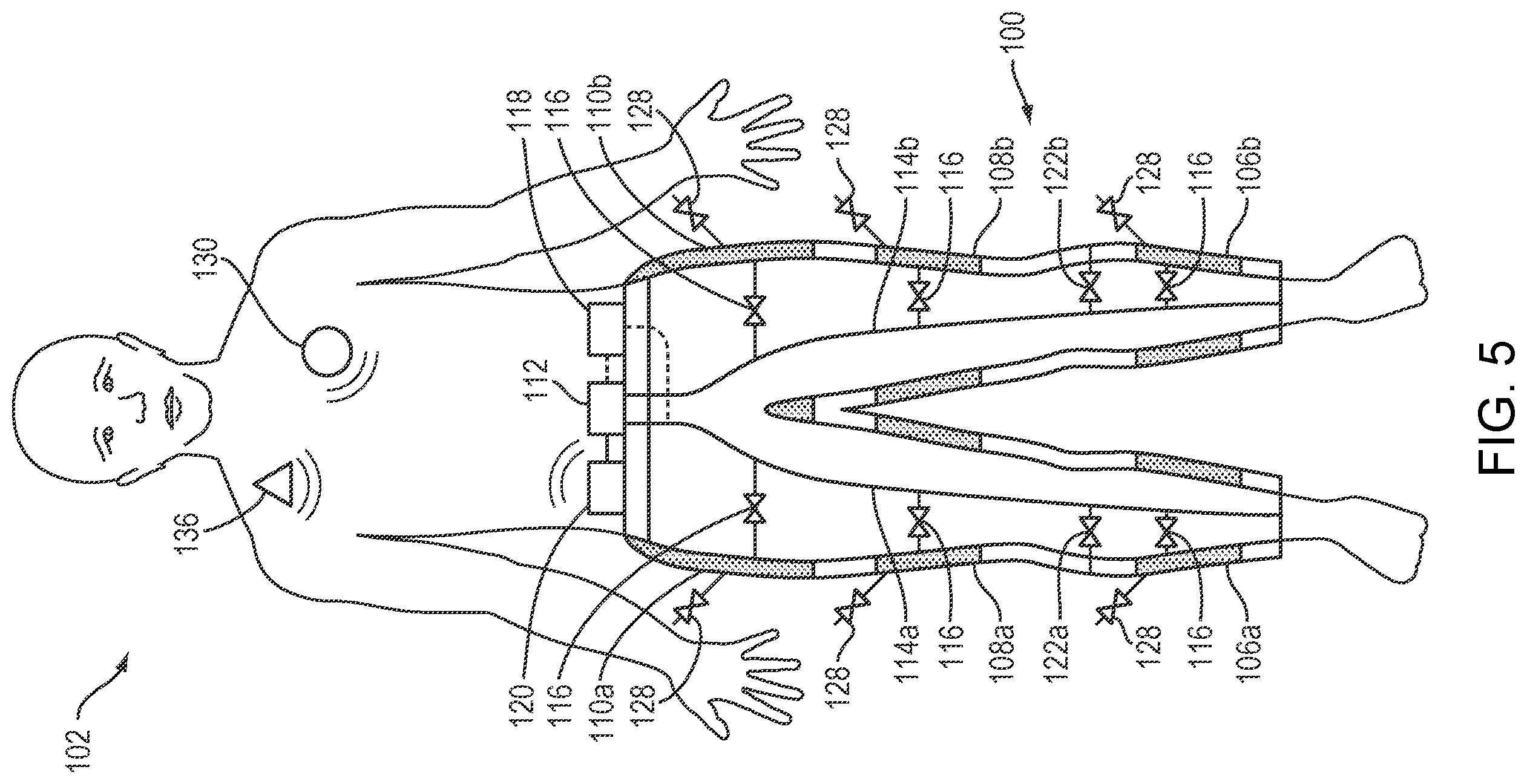 Patent US12599535 Figure 4 – External counterpulsation system