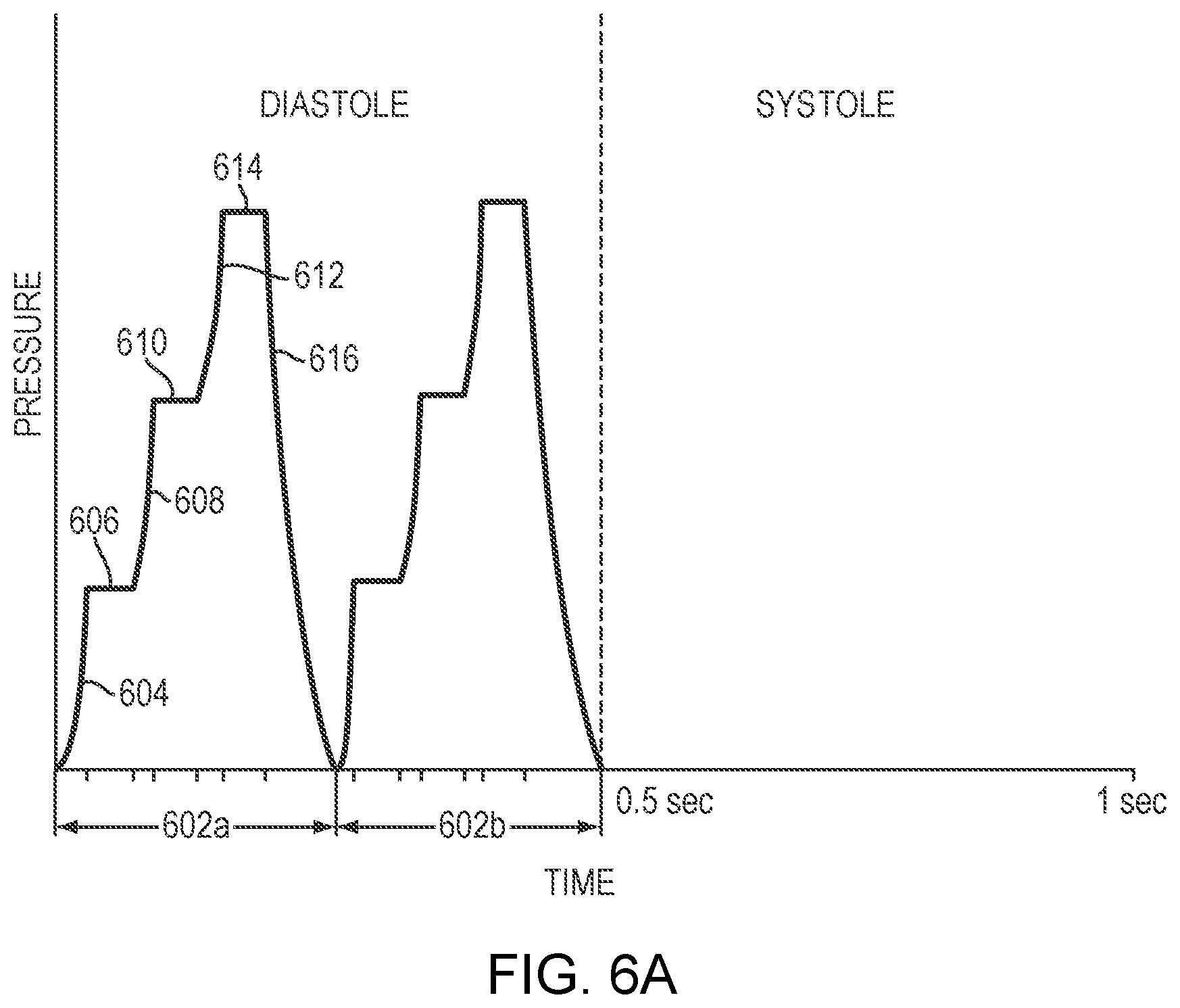 Patent US12599535 Figure 5 – External counterpulsation system