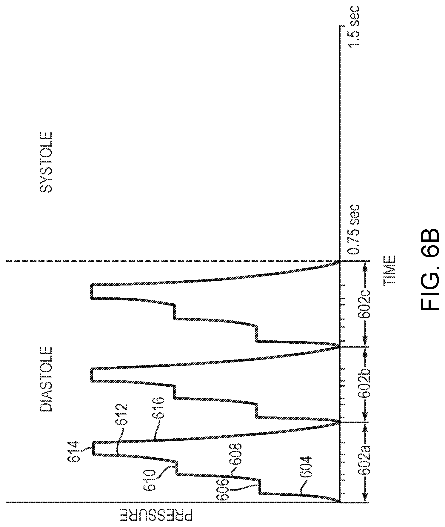 Patent US12599535 Figure 6 – External counterpulsation system