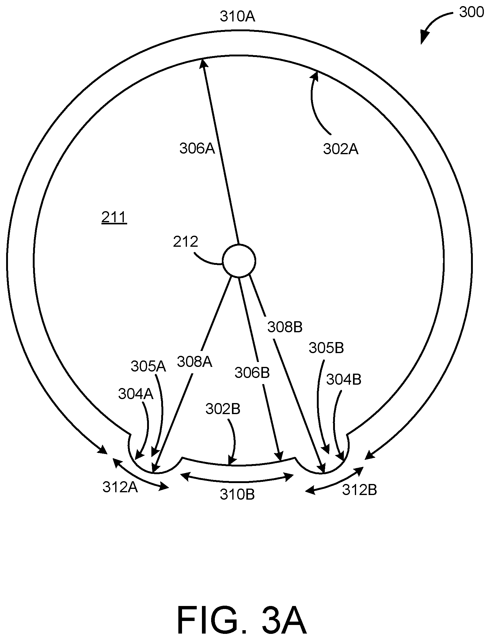 Patent US12599538 Figure 4 – Inflatable penile prosthesis with channels in valve of guide assembly