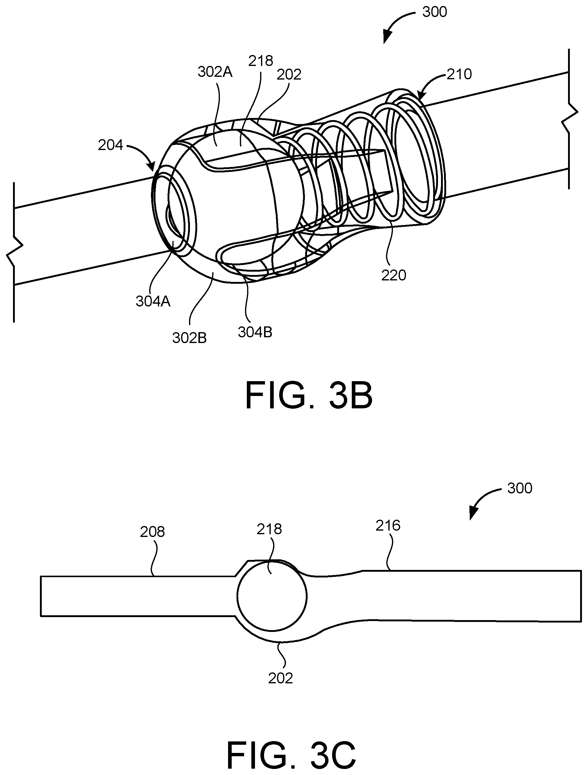 Patent US12599538 Figure 5 – Inflatable penile prosthesis with channels in valve of guide assembly