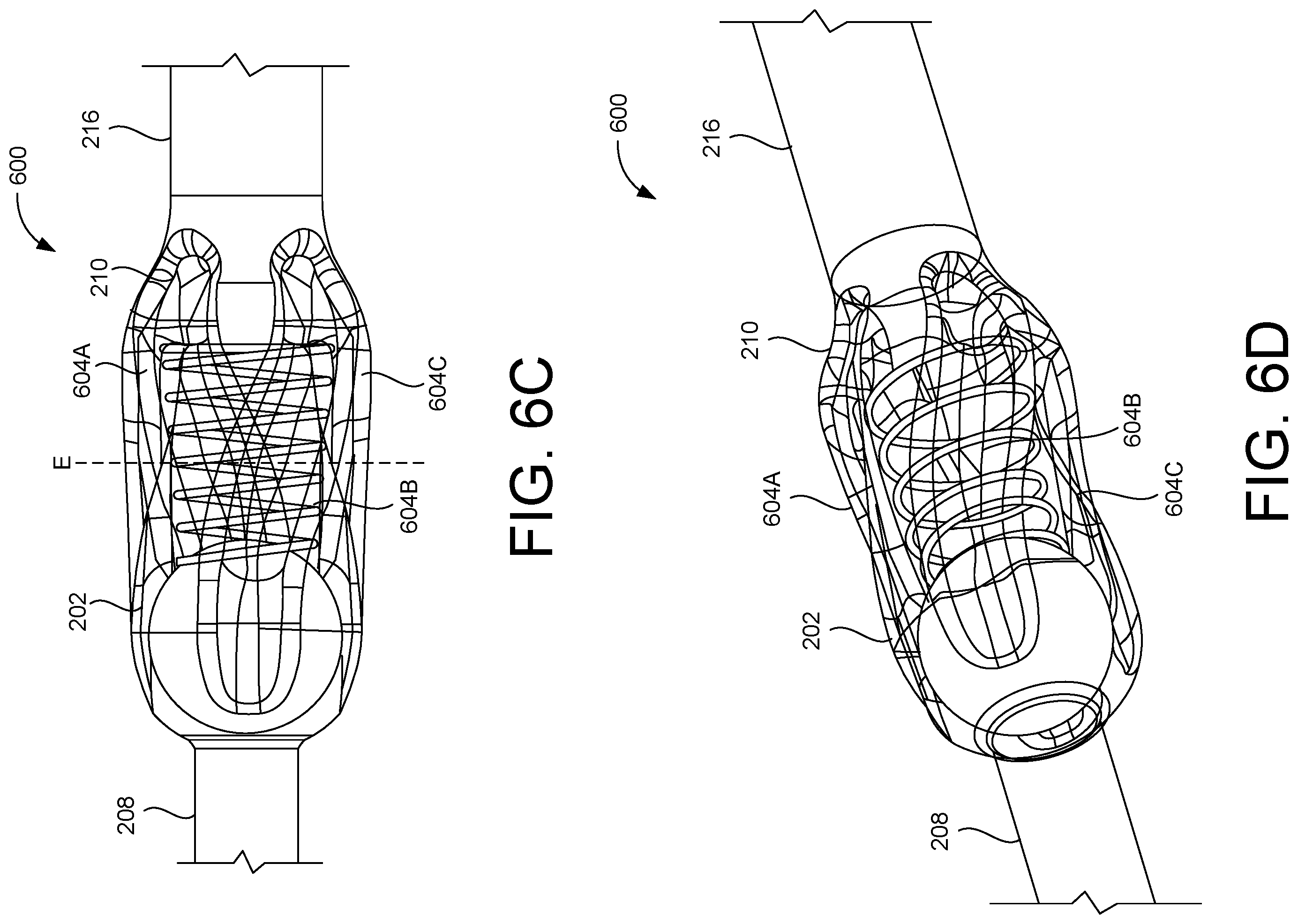 Patent US12599538 Figure 11 – Inflatable penile prosthesis with channels in valve of guide assembly