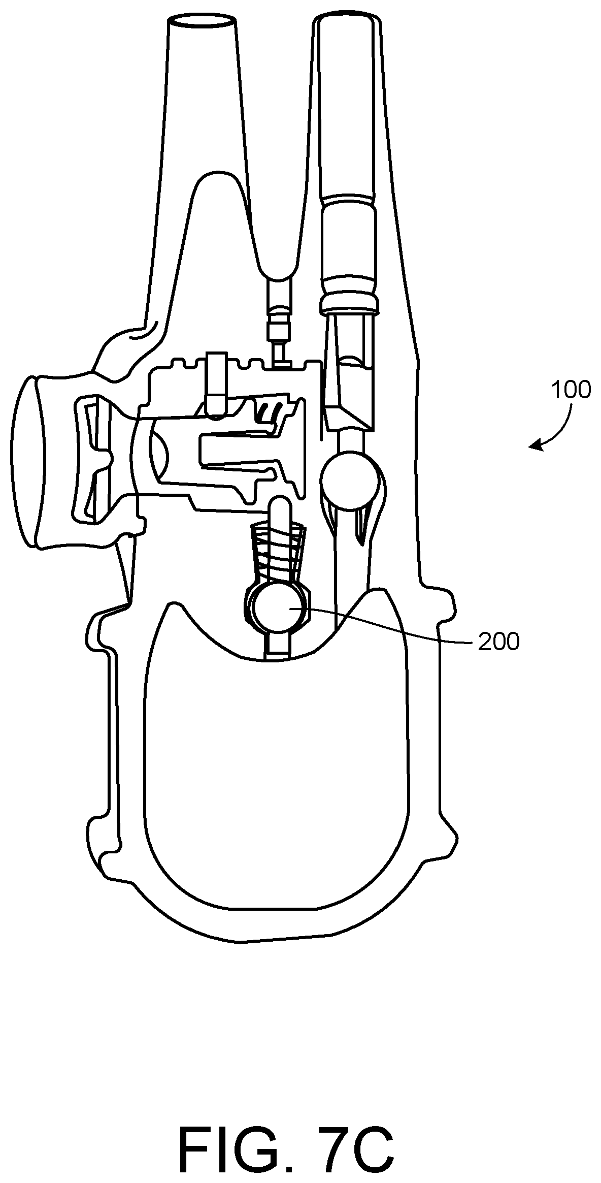 Patent US12599538 Figure 15 – Inflatable penile prosthesis with channels in valve of guide assembly