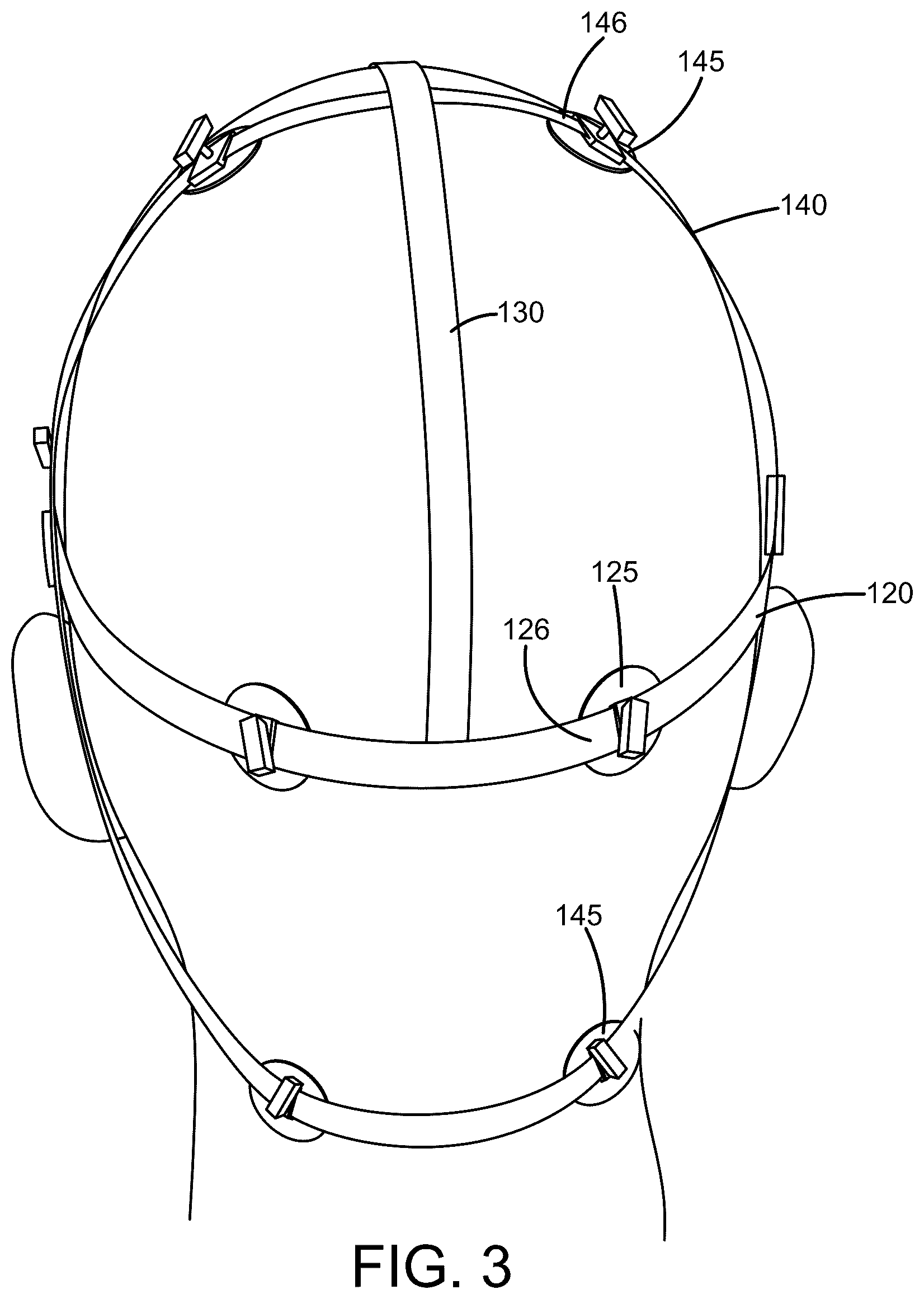 Patent US12599540 Figure 3 – Pressure pad headgear device