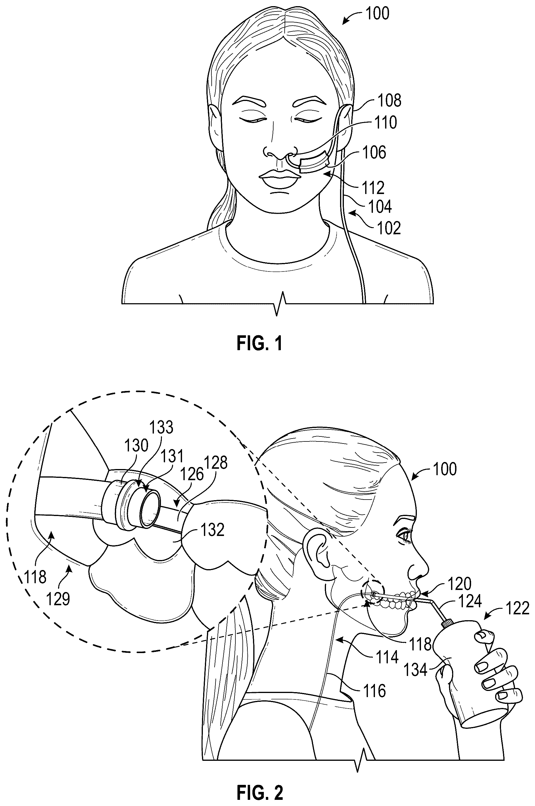 Patent US12599544 Figure 1 – Intraoral gastrointestinal access device and related methods