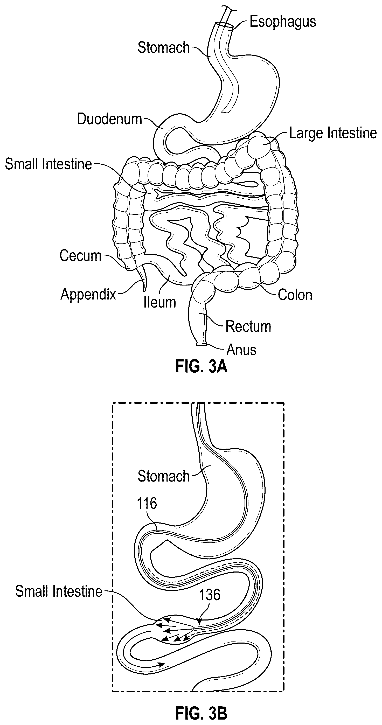 Patent US12599544 Figure 2 – Intraoral gastrointestinal access device and related methods