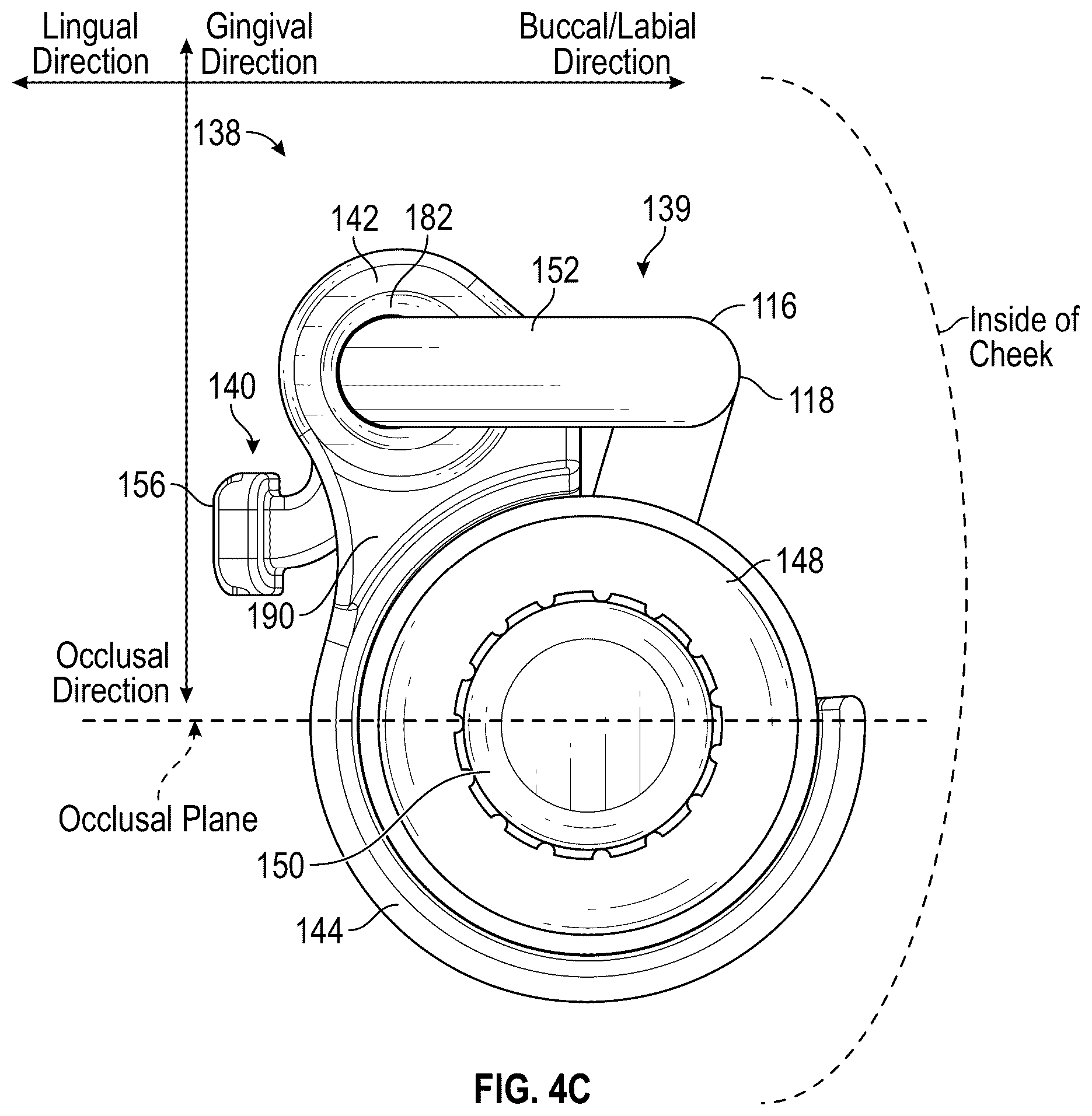 Patent US12599544 Figure 4 – Intraoral gastrointestinal access device and related methods