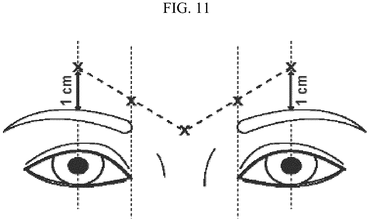 Patent US12599549 Figure 11 – Treatment of moderate to very severe glabellar lines and lateral canthal lines