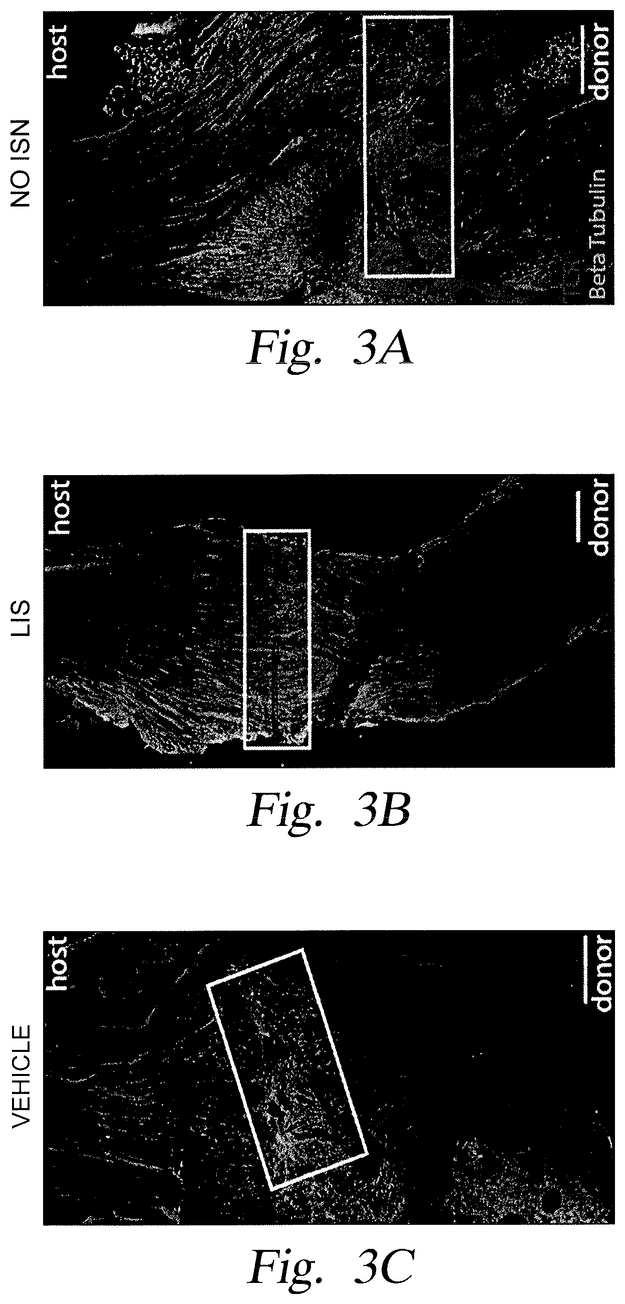 Patent US12599561 Figure 4 – Localized immunosuppression of allografts for peripheral nerve repair