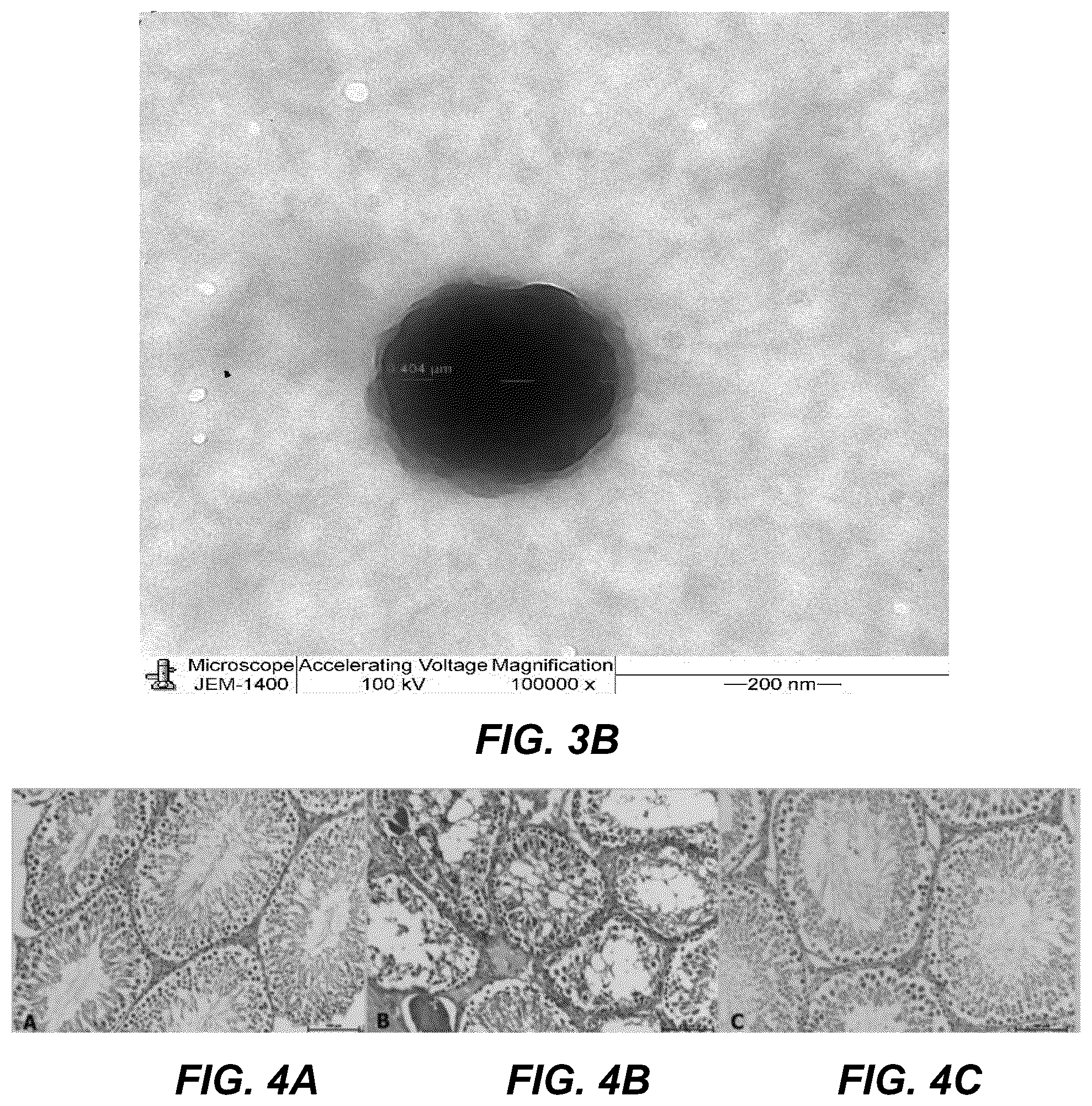 Patent US12599569 Figure 4 – Encapsulated resveratrol (RSV) nanoparticles