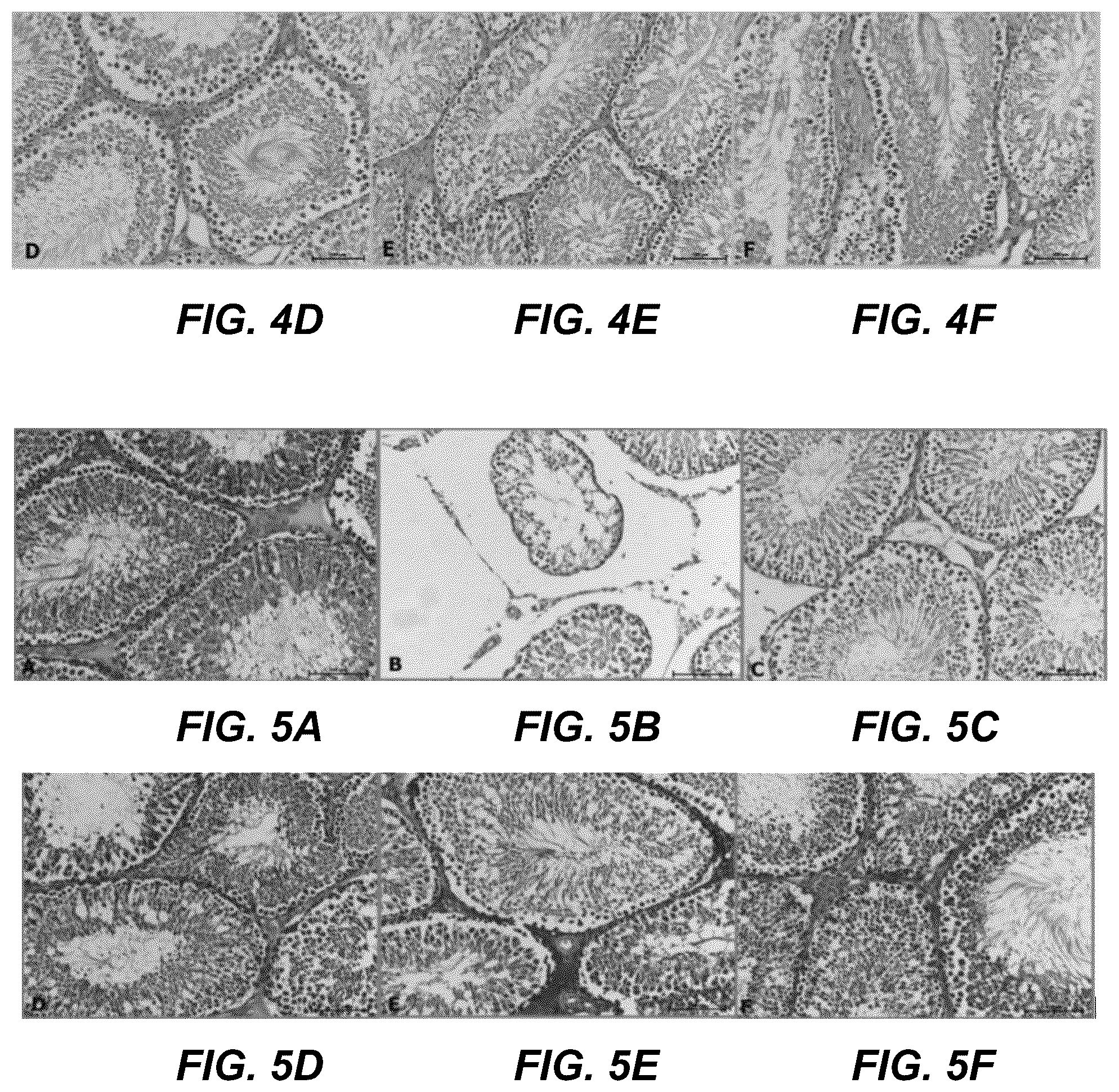 Patent US12599569 Figure 5 – Encapsulated resveratrol (RSV) nanoparticles