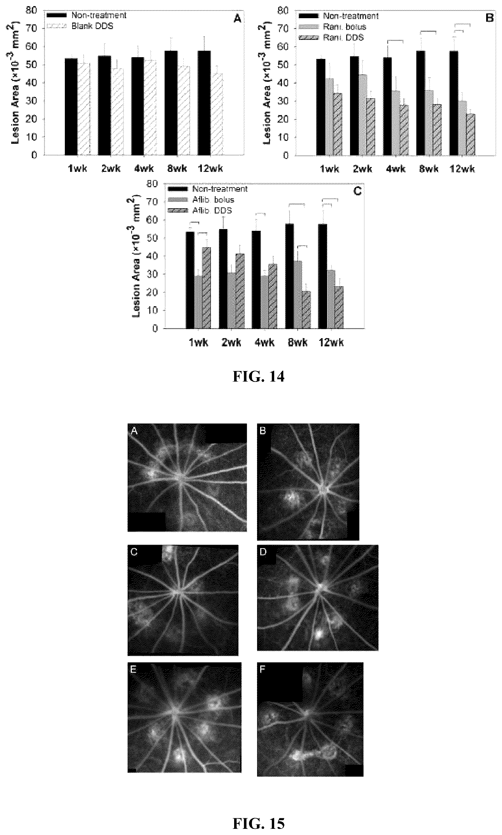 Patent US12599570 Figure 10 – Biodegradable extended release microsphere-hydrogel ocular drug delivery system and method
