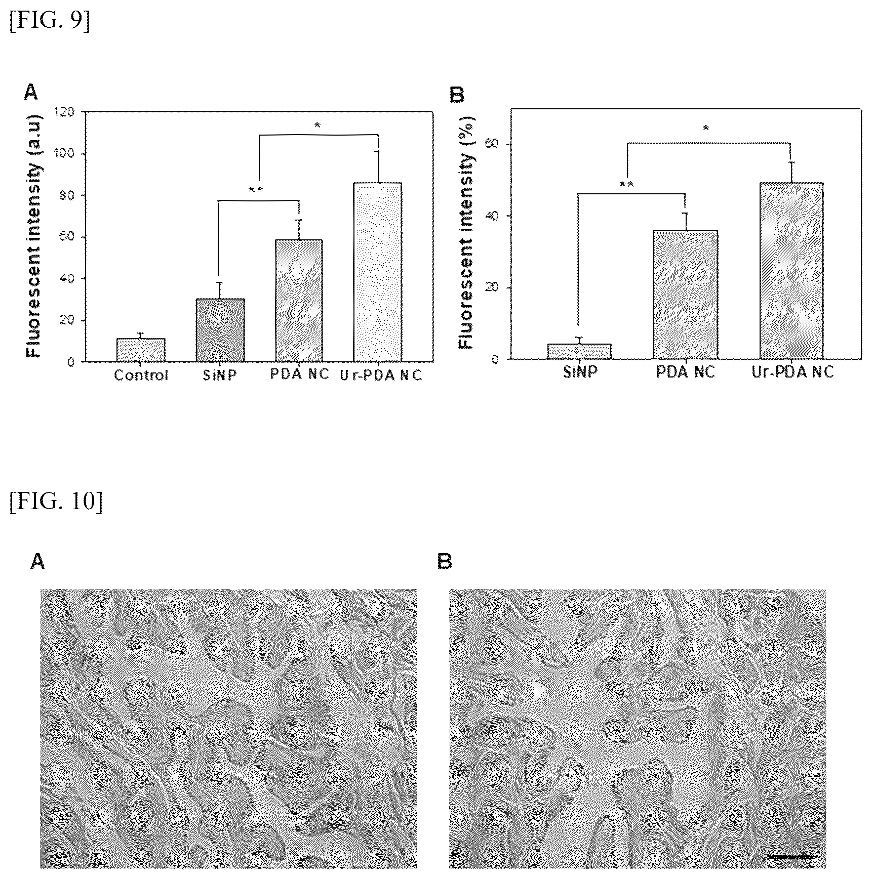 Patent US12599571 Figure 9 – Method for preparing polydopamine nanomotor using urease, and use of same