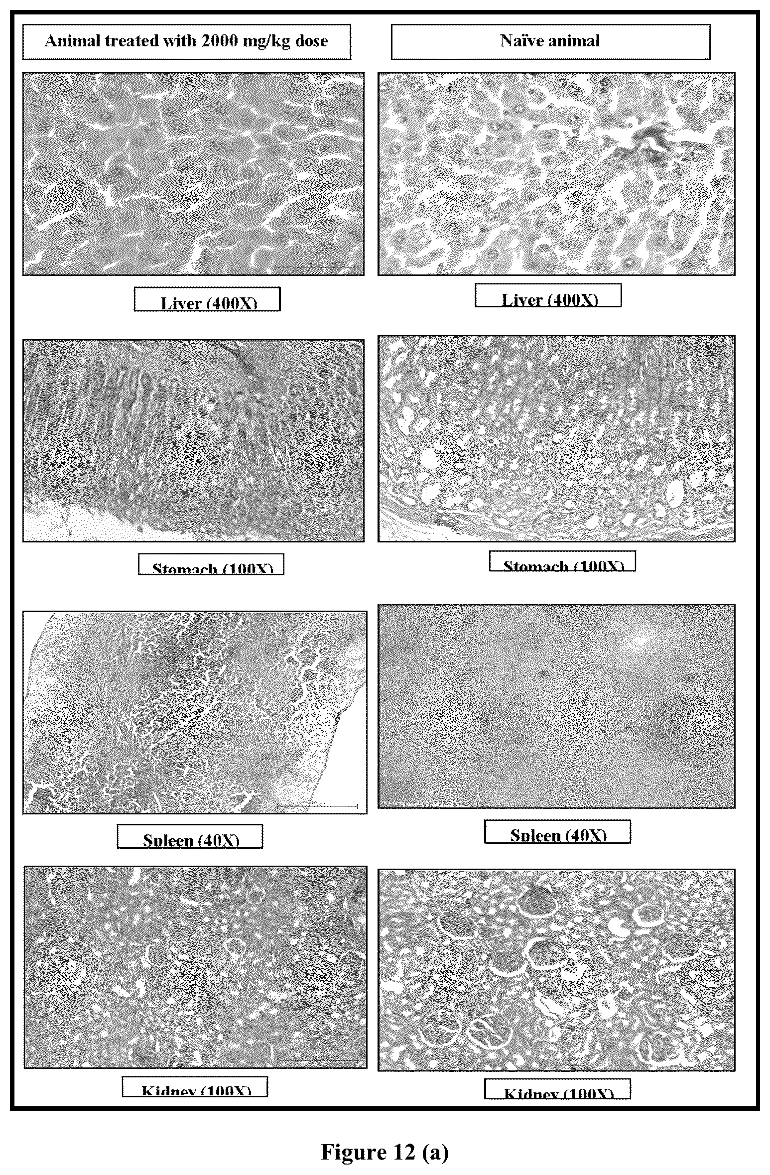 Patent US12599572 Figure 8 – Solid lipid nanoparticles of curcumin