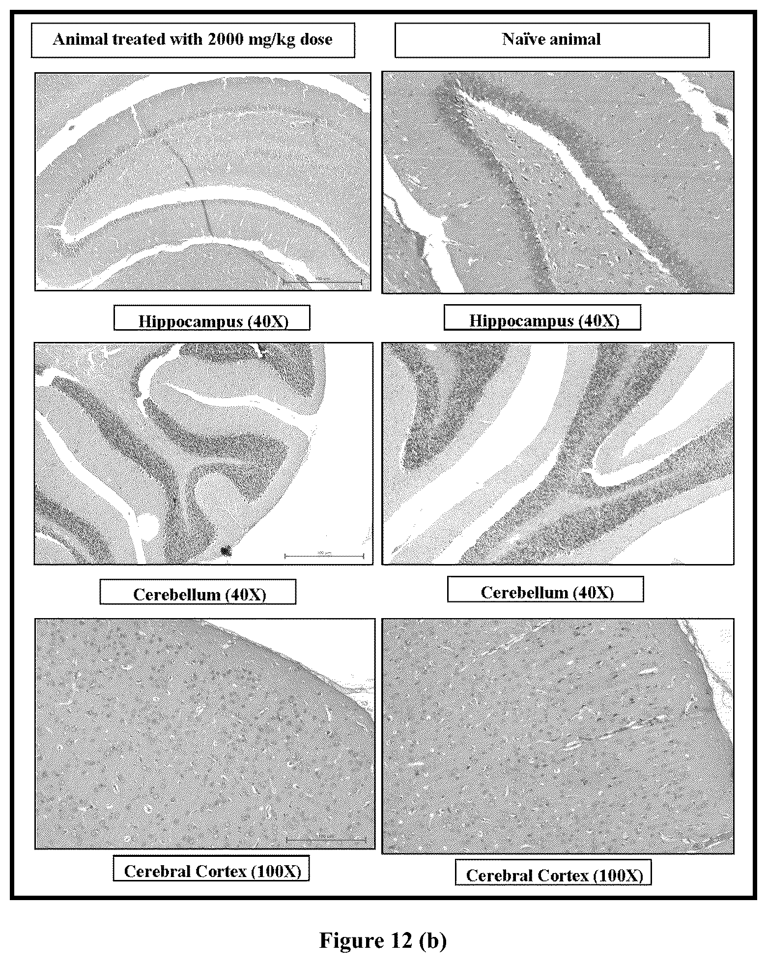 Patent US12599572 Figure 9 – Solid lipid nanoparticles of curcumin