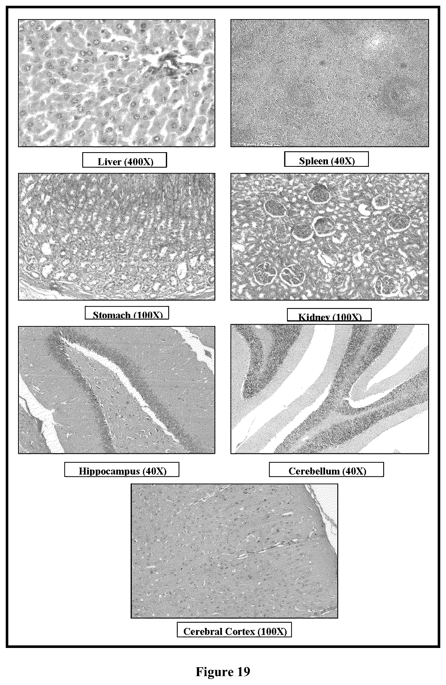Patent US12599572 Figure 13 – Solid lipid nanoparticles of curcumin