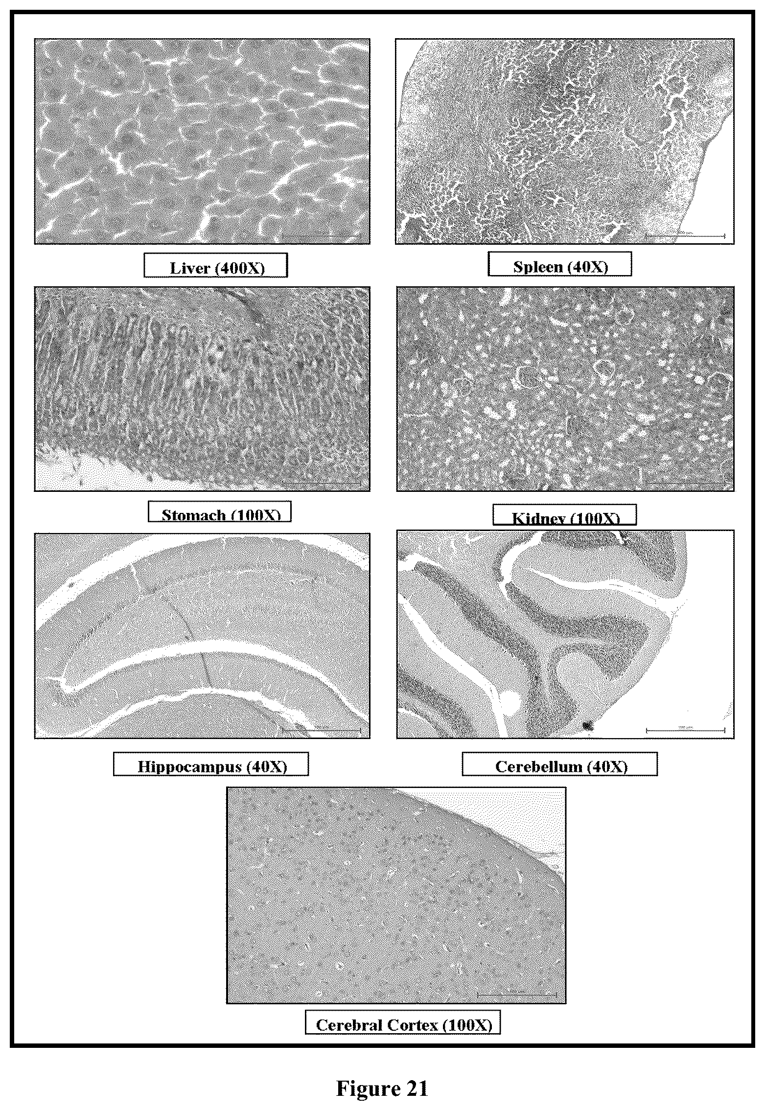 Patent US12599572 Figure 15 – Solid lipid nanoparticles of curcumin