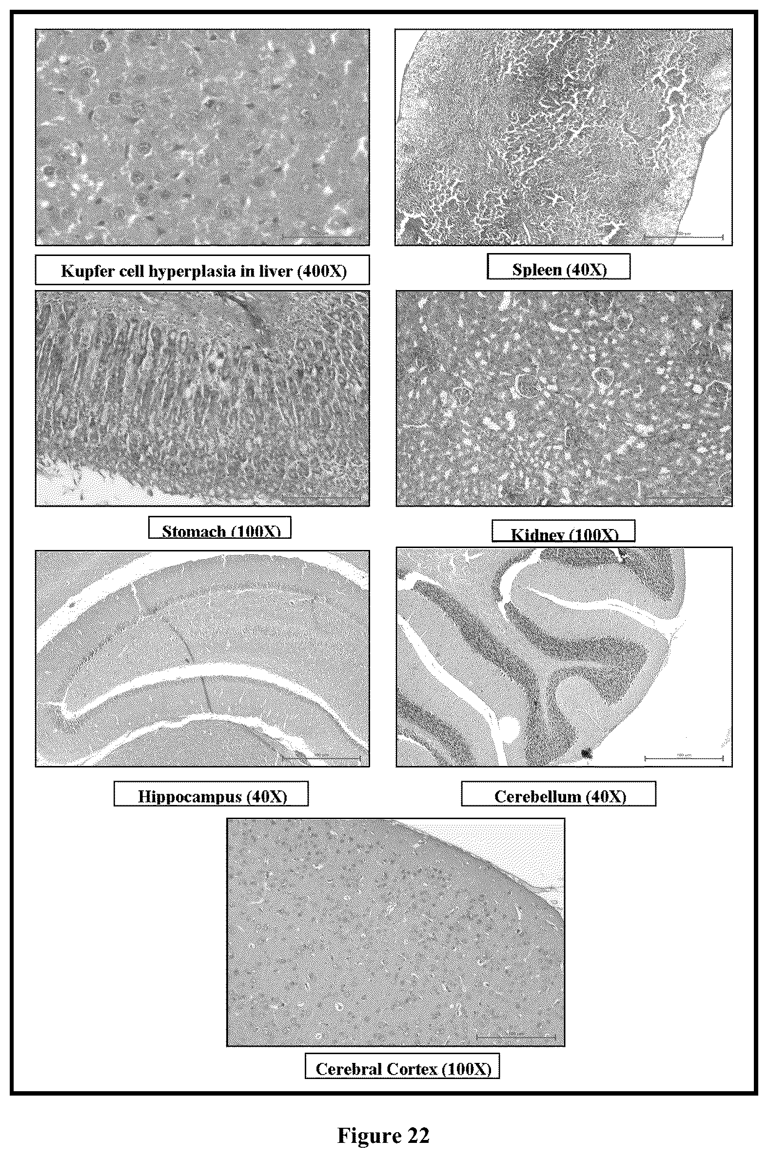 Patent US12599572 Figure 16 – Solid lipid nanoparticles of curcumin