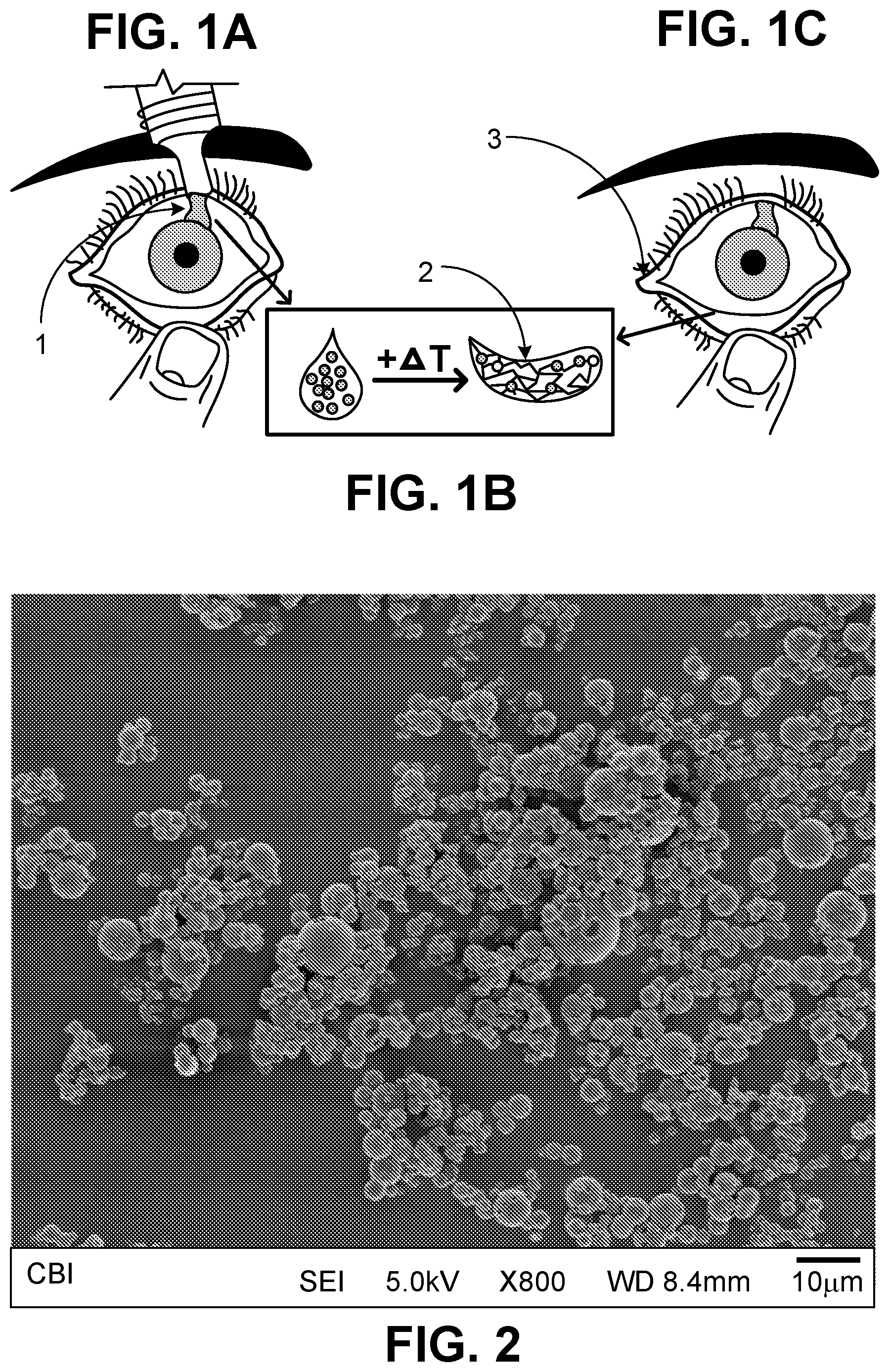 Patent US12599577 Figure 1 – Thermoresponsive gel eye drop for ocular delivery of cysteamine