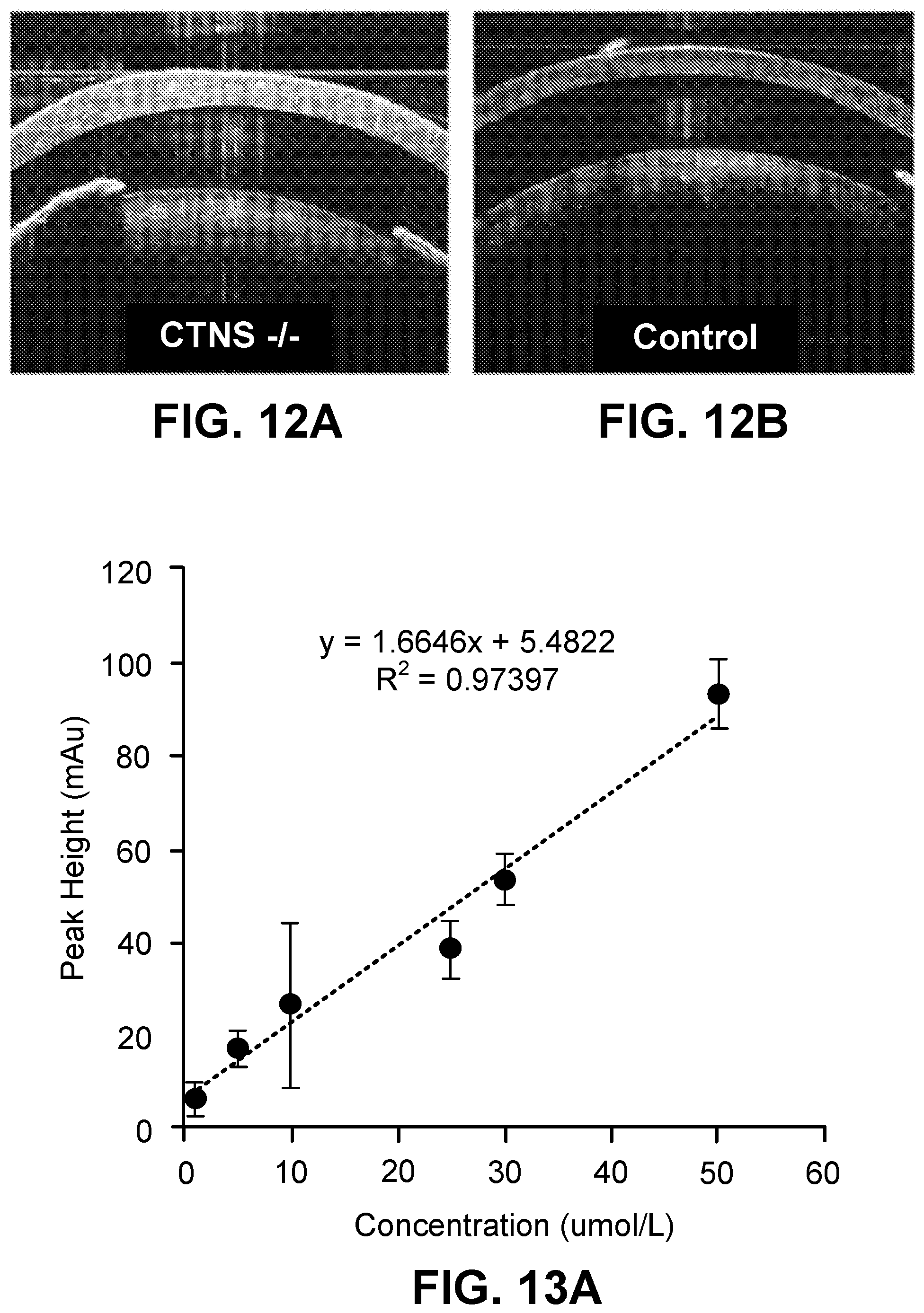 Patent US12599577 Figure 8 – Thermoresponsive gel eye drop for ocular delivery of cysteamine