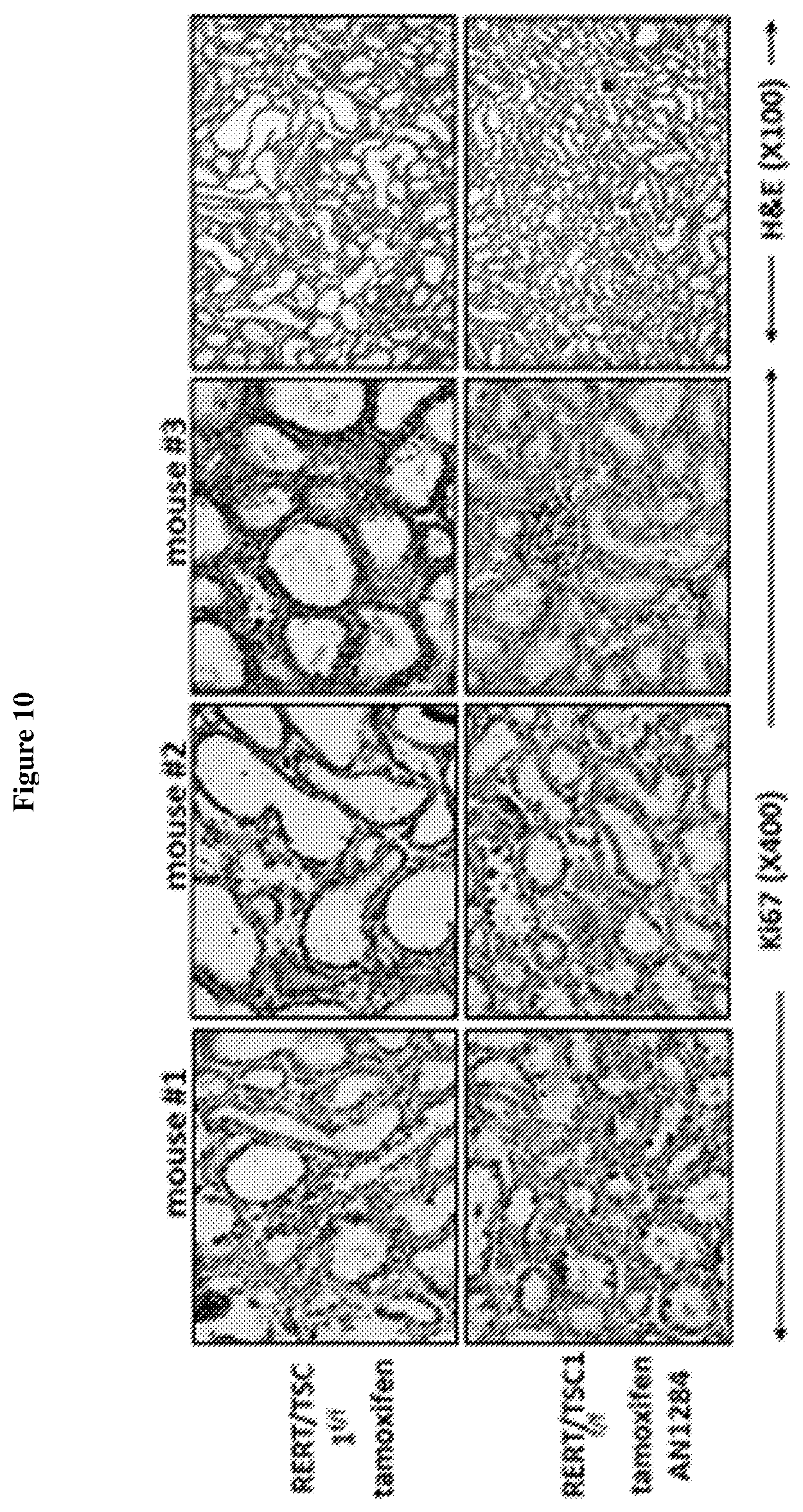 Patent US12599584 Figure 10 – Indoline derivatives, compositions comprising them and uses thereof