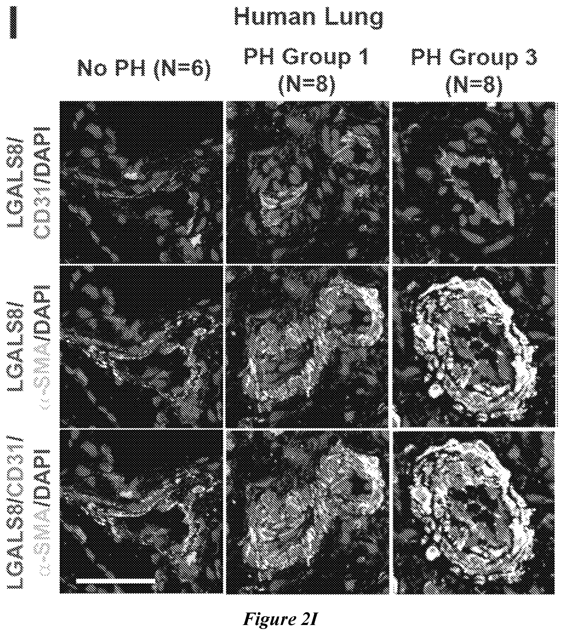 Patent US12599592 Figure 6 – Therapeutic small molecules for treatment of pulmonary hypertension