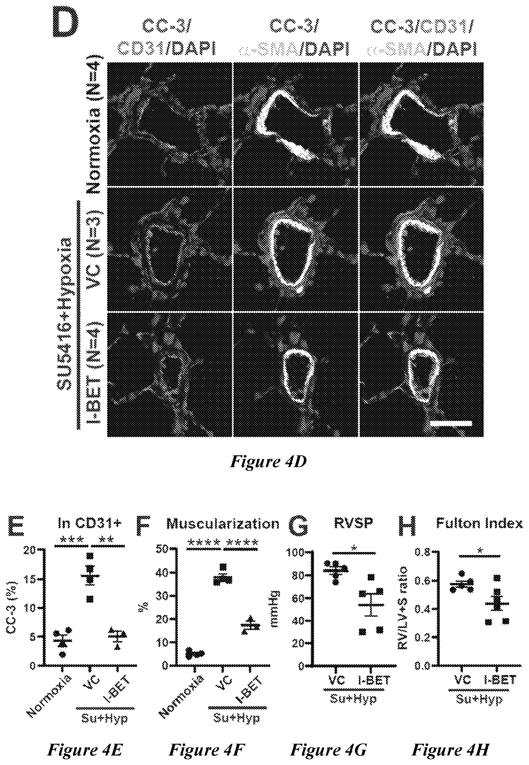 Patent US12599592 Figure 11 – Therapeutic small molecules for treatment of pulmonary hypertension