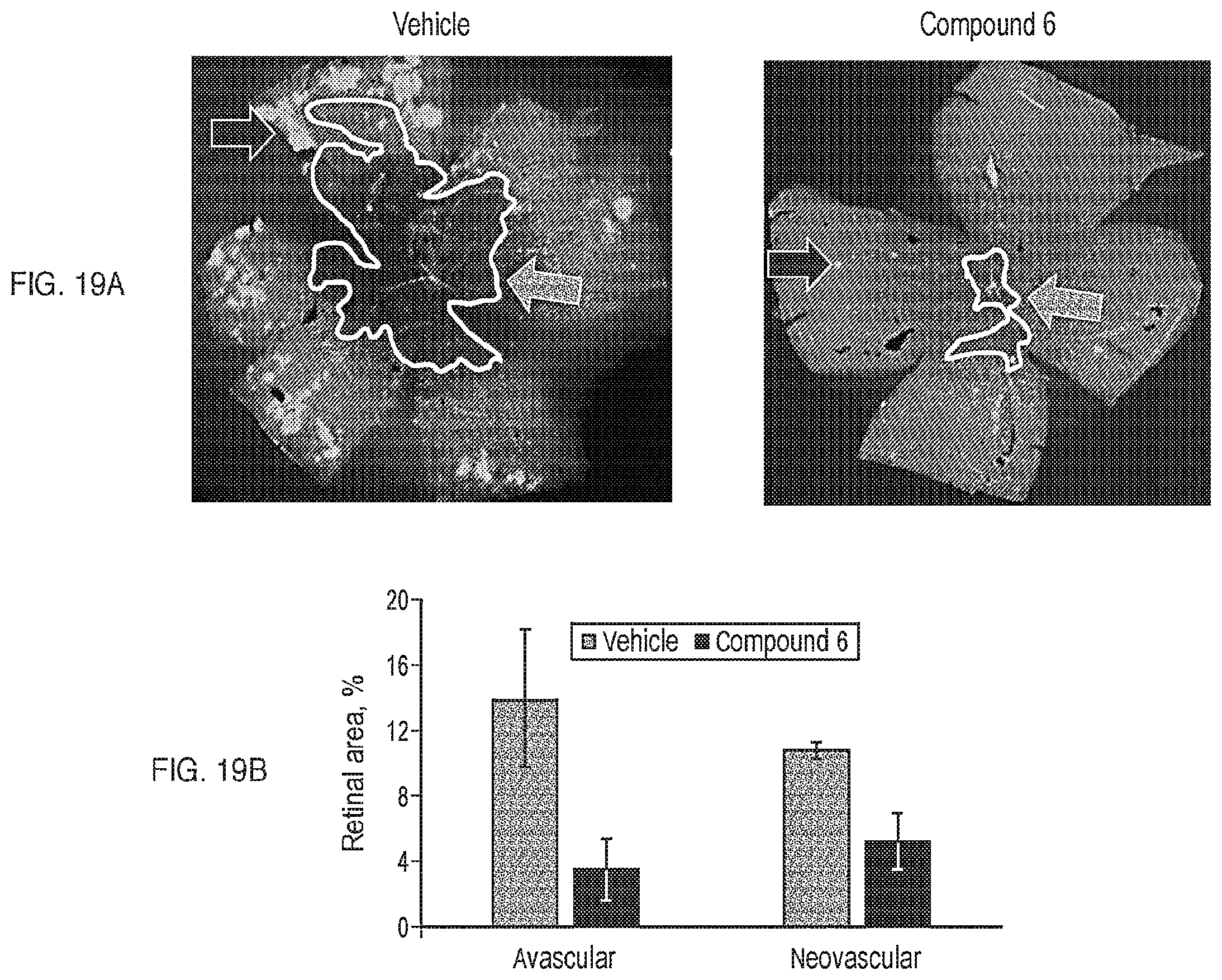 Patent US12599599 Figure 19 – Anti-inflammatory, anti-cancer, and anti-angiogenic compounds, pharmaceutical compositions, and methods of making and using thereof