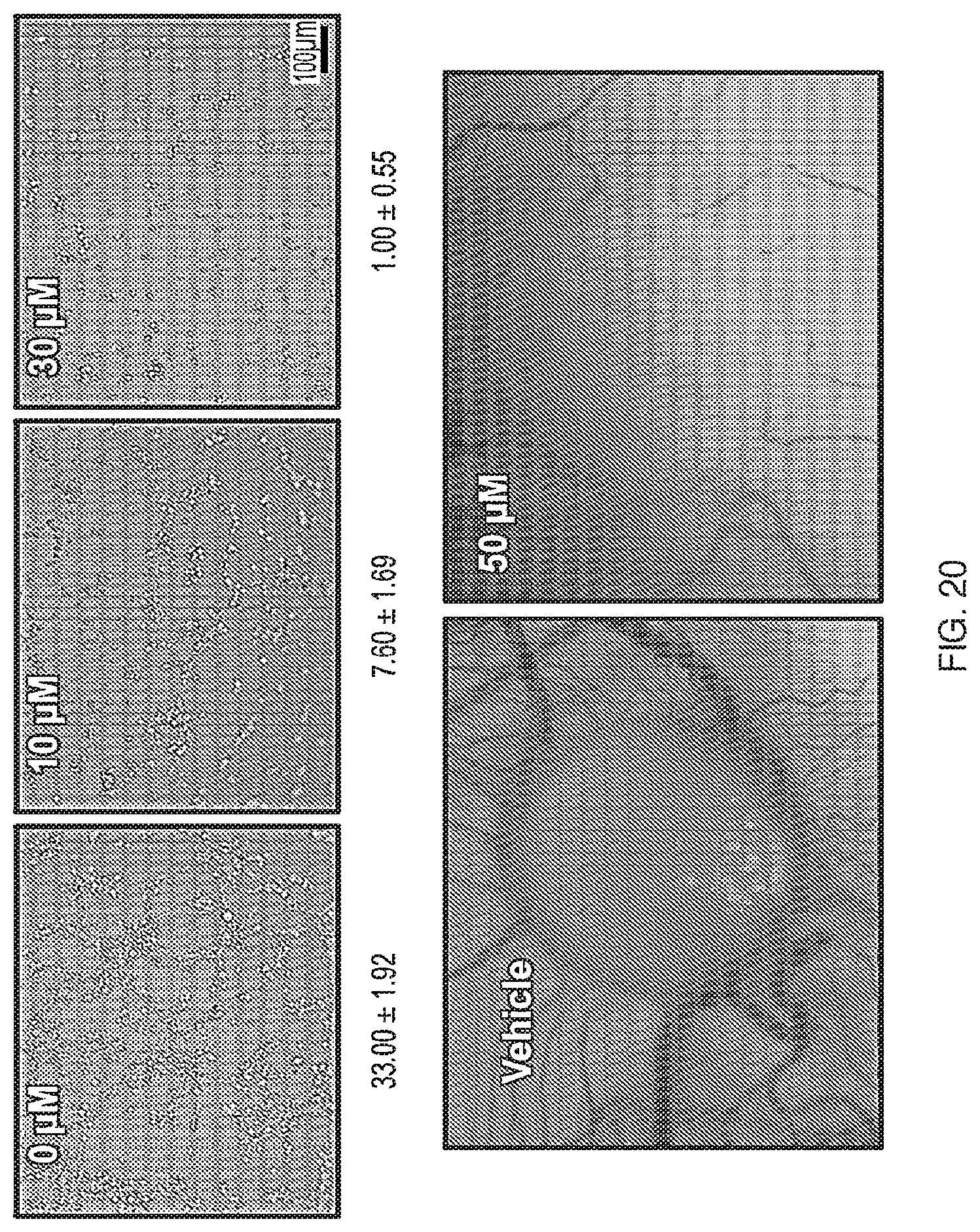 Patent US12599599 Figure 20 – Anti-inflammatory, anti-cancer, and anti-angiogenic compounds, pharmaceutical compositions, and methods of making and using thereof