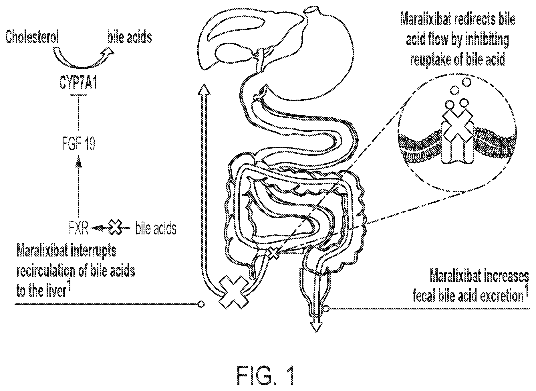 Patent US12599602 Figure 1 – Methods for treating cholestasis