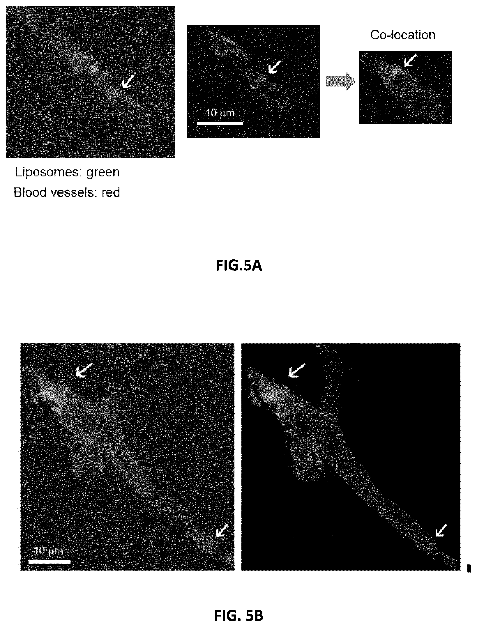 Patent US12599605 Figure 3 – Uric acid liposomes