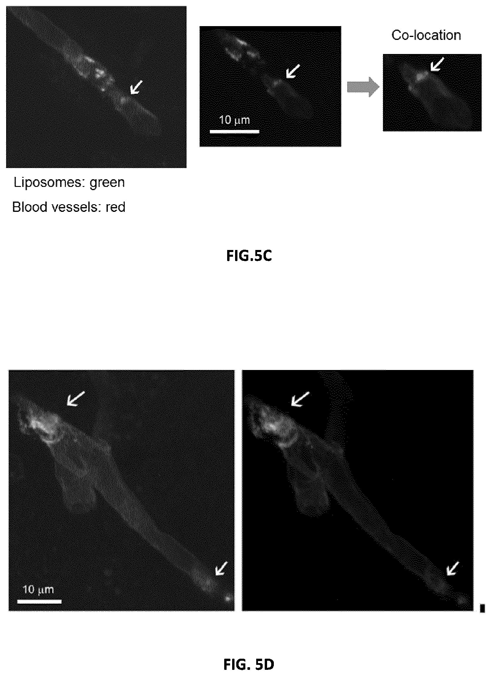 Patent US12599605 Figure 4 – Uric acid liposomes