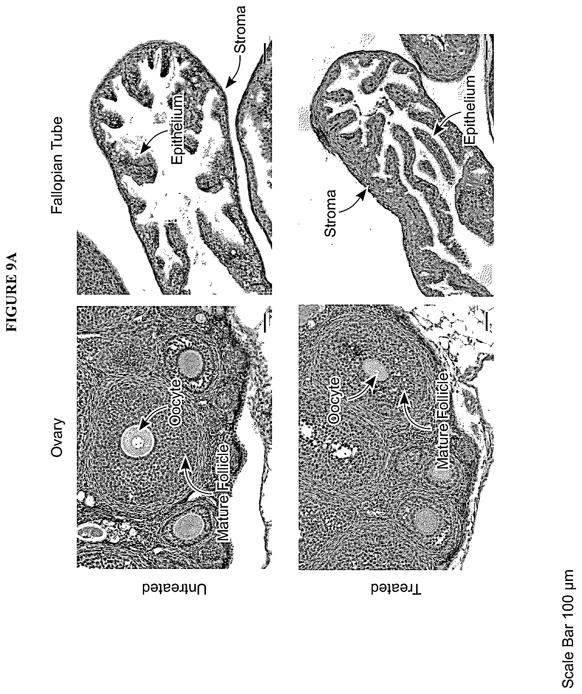 Patent US12599617 Figure 16 – Methods of treating head and neck cancers with hemp extract