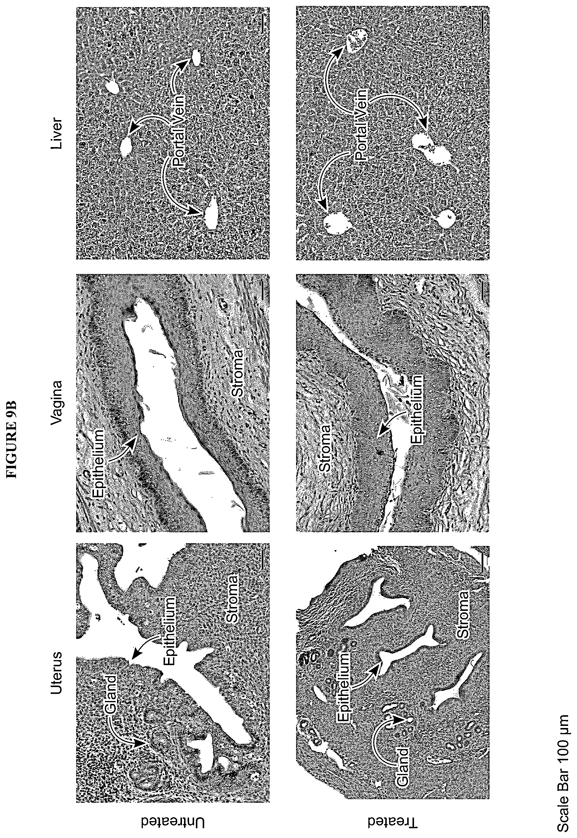 Patent US12599617 Figure 17 – Methods of treating head and neck cancers with hemp extract