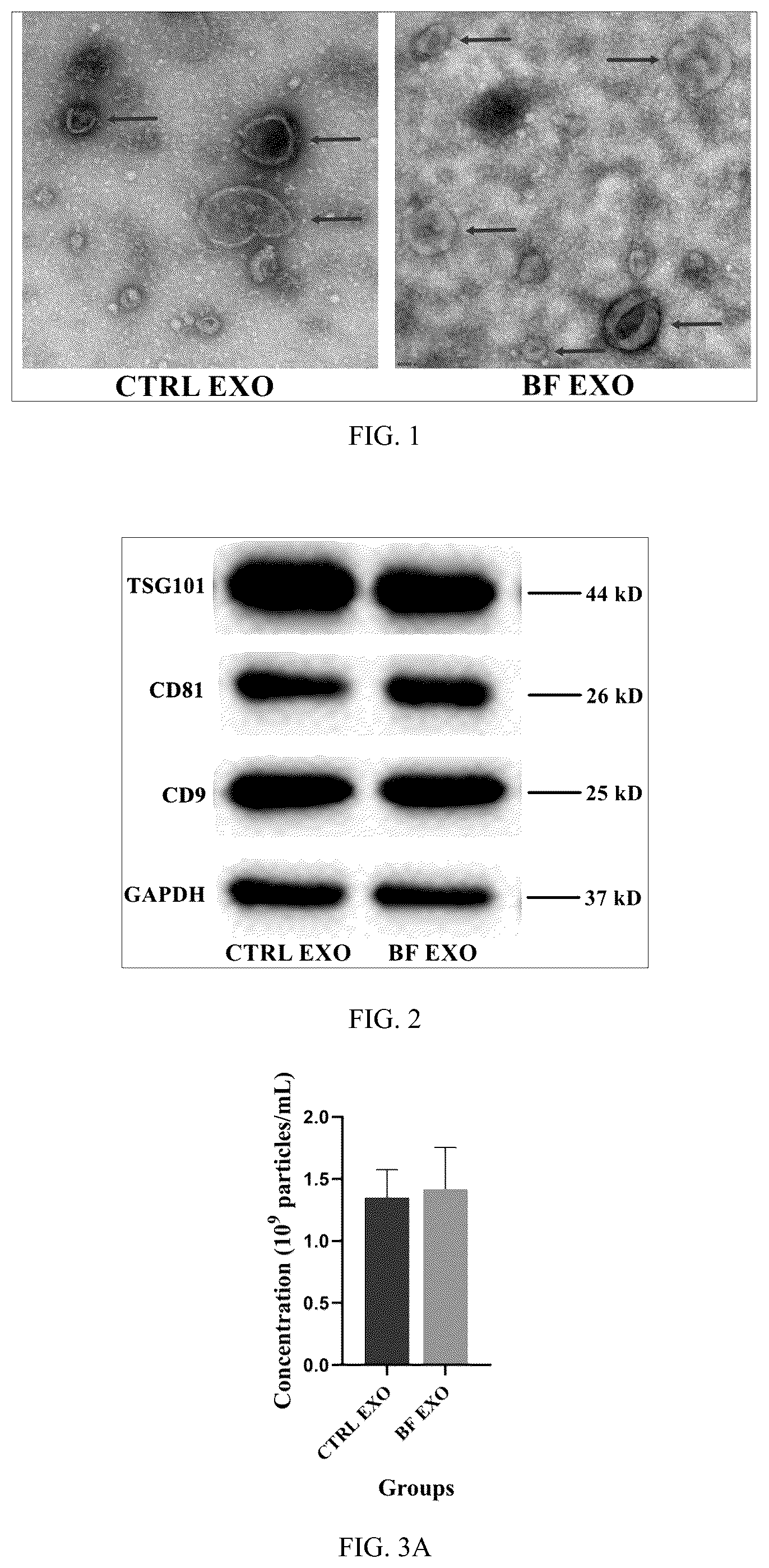 Patent US12599630 Figure 1 – Serum exosome with high osteogenesis and high angiogenesis, preparation method, and application thereof
