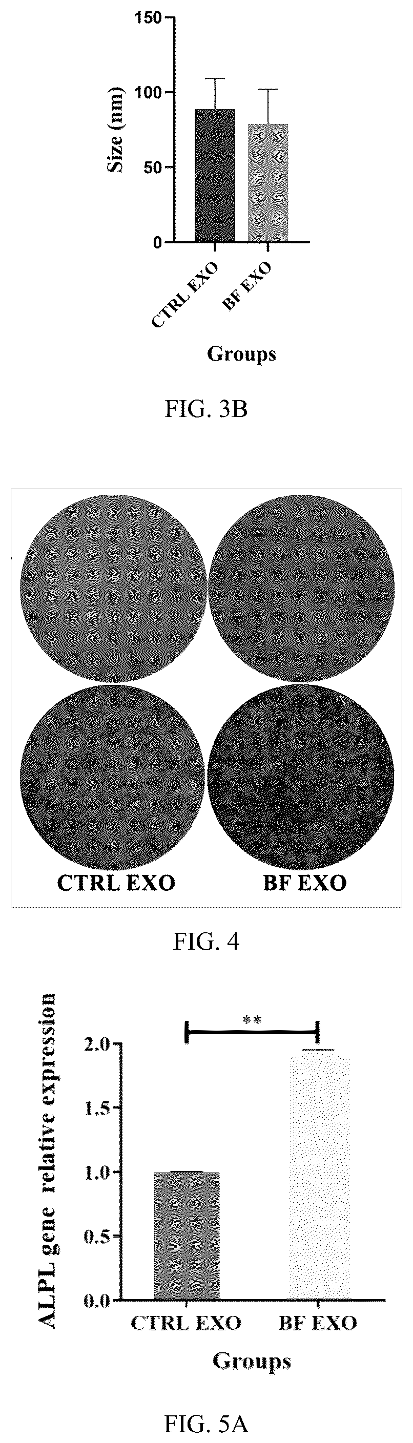 Patent US12599630 Figure 2 – Serum exosome with high osteogenesis and high angiogenesis, preparation method, and application thereof