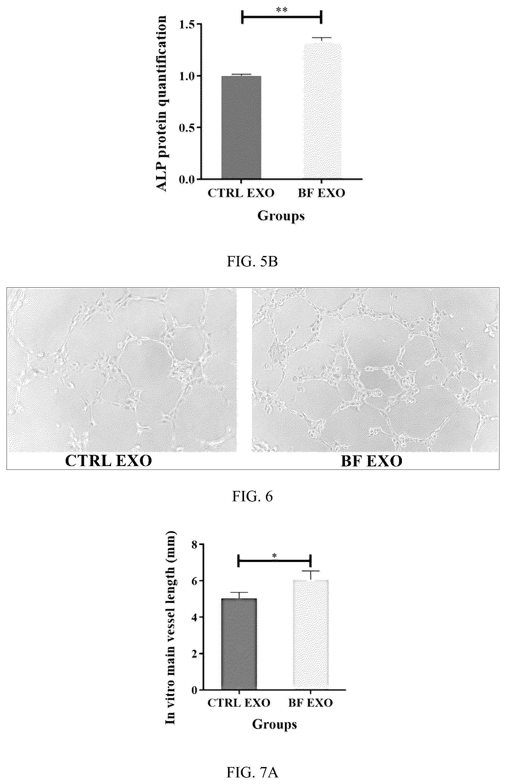 Patent US12599630 Figure 3 – Serum exosome with high osteogenesis and high angiogenesis, preparation method, and application thereof
