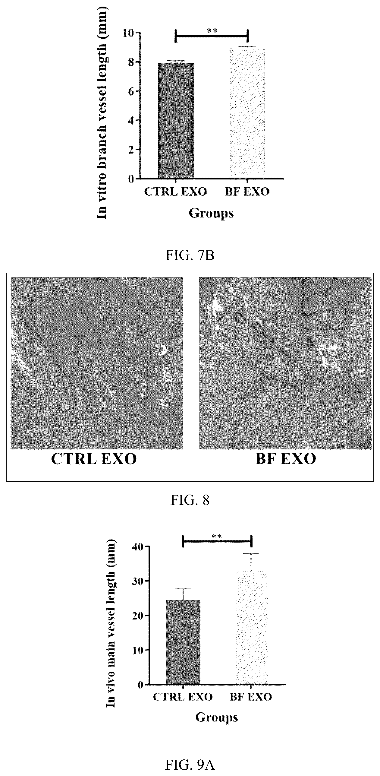 Patent US12599630 Figure 4 – Serum exosome with high osteogenesis and high angiogenesis, preparation method, and application thereof