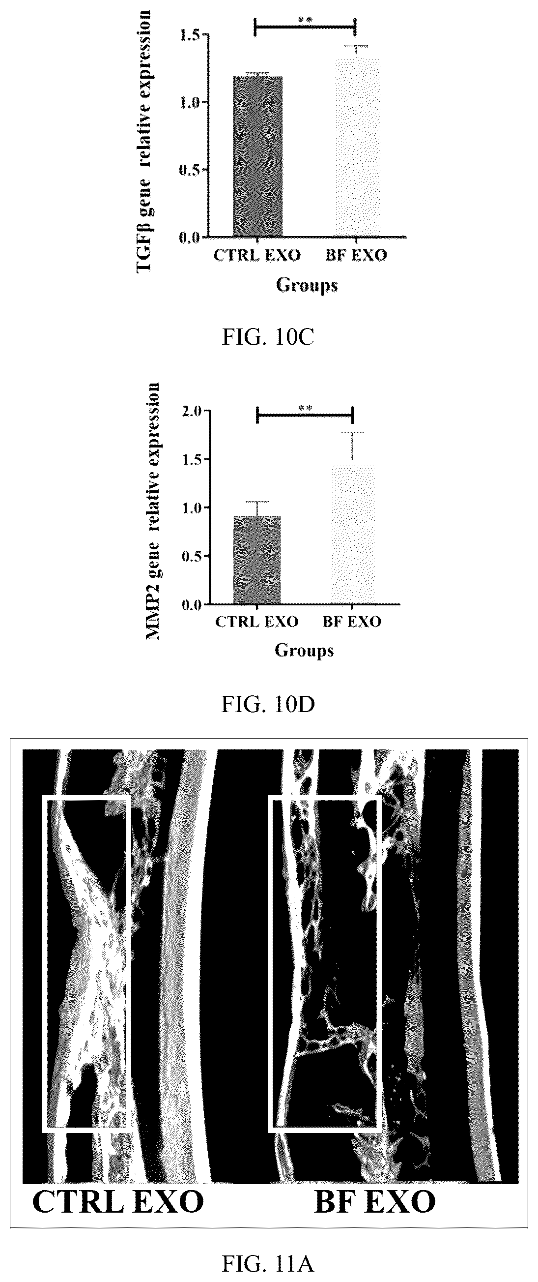 Patent US12599630 Figure 6 – Serum exosome with high osteogenesis and high angiogenesis, preparation method, and application thereof