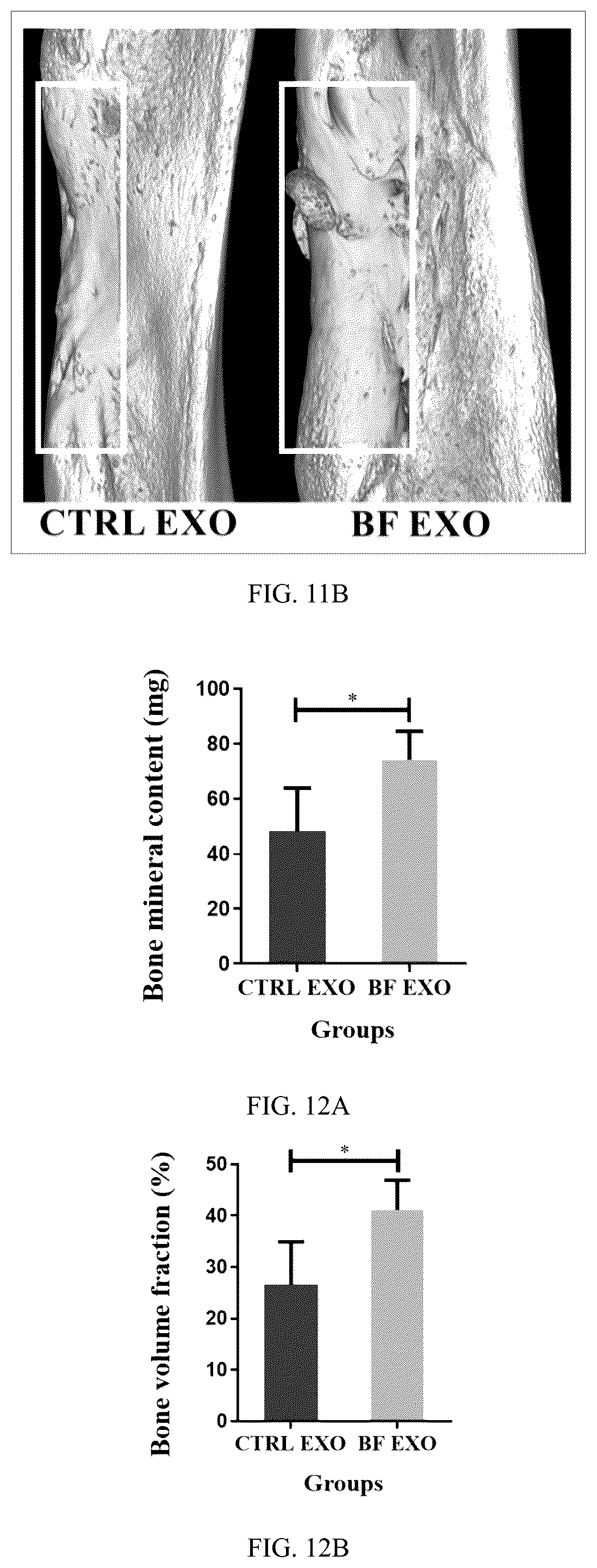 Patent US12599630 Figure 7 – Serum exosome with high osteogenesis and high angiogenesis, preparation method, and application thereof