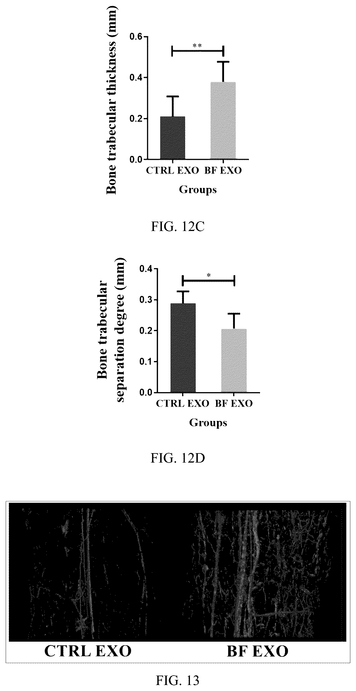 Patent US12599630 Figure 8 – Serum exosome with high osteogenesis and high angiogenesis, preparation method, and application thereof