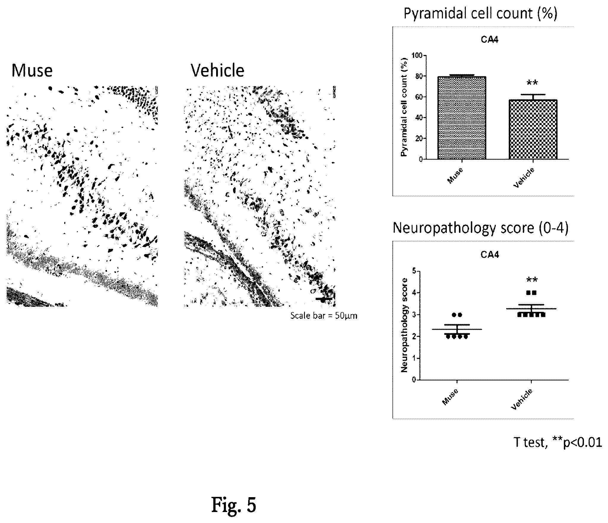 Patent US12599631 Figure 4 – Agent for treating or preventing vascular dementia