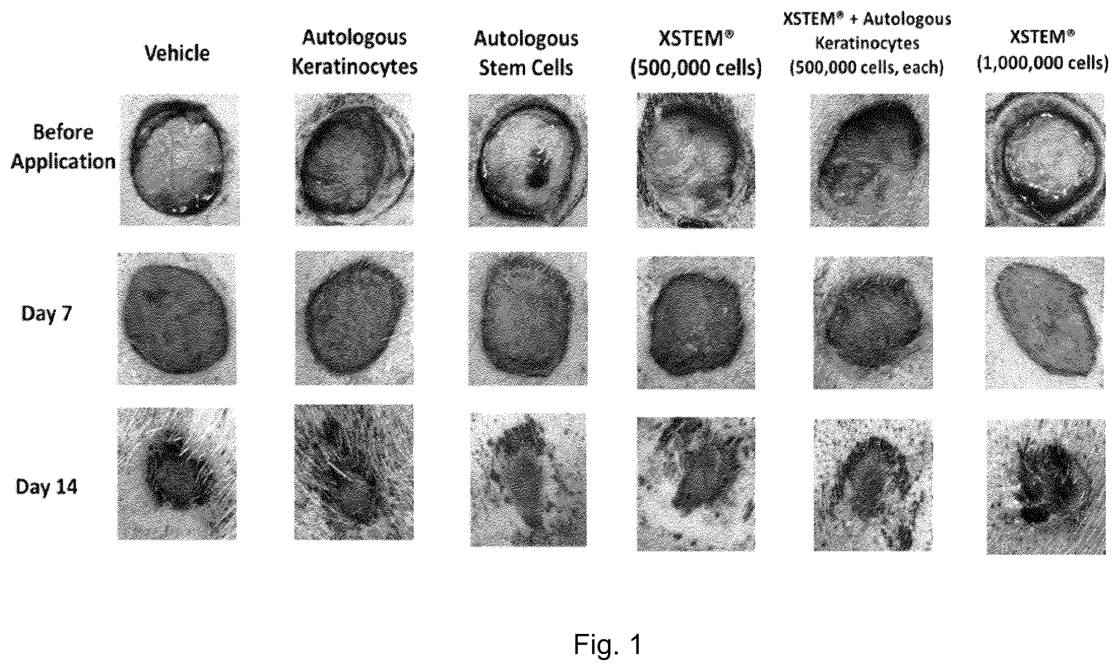 Patent US12599633 Figure 1 – Mesenchymal stem cells for use in the treatment of skin defects