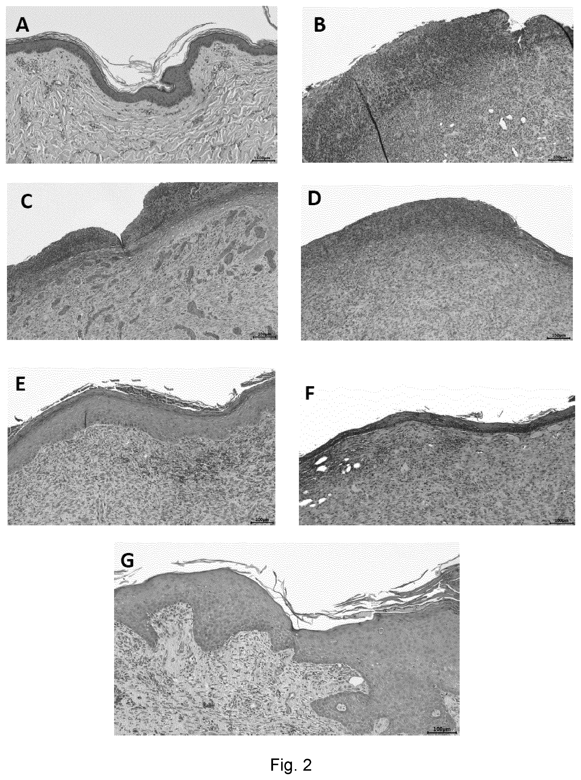 Patent US12599633 Figure 2 – Mesenchymal stem cells for use in the treatment of skin defects