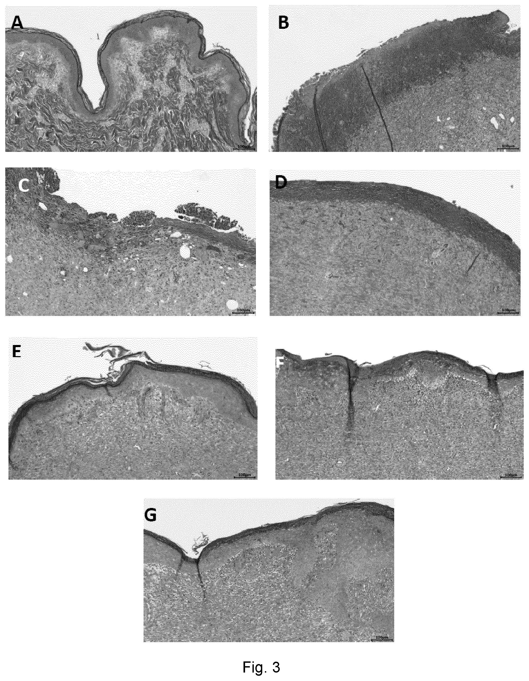 Patent US12599633 Figure 3 – Mesenchymal stem cells for use in the treatment of skin defects